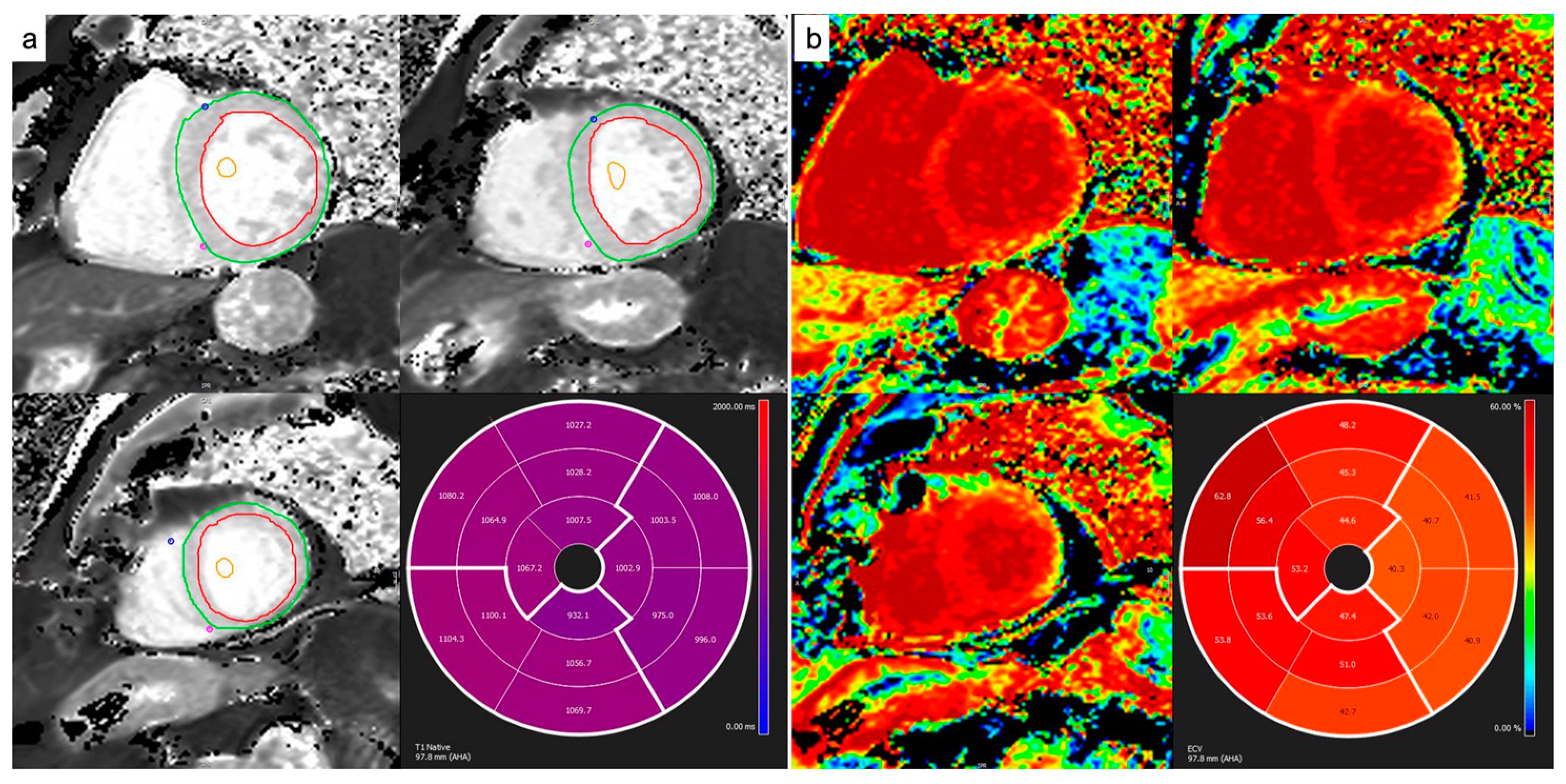 Diagnostics 14 01048 g001