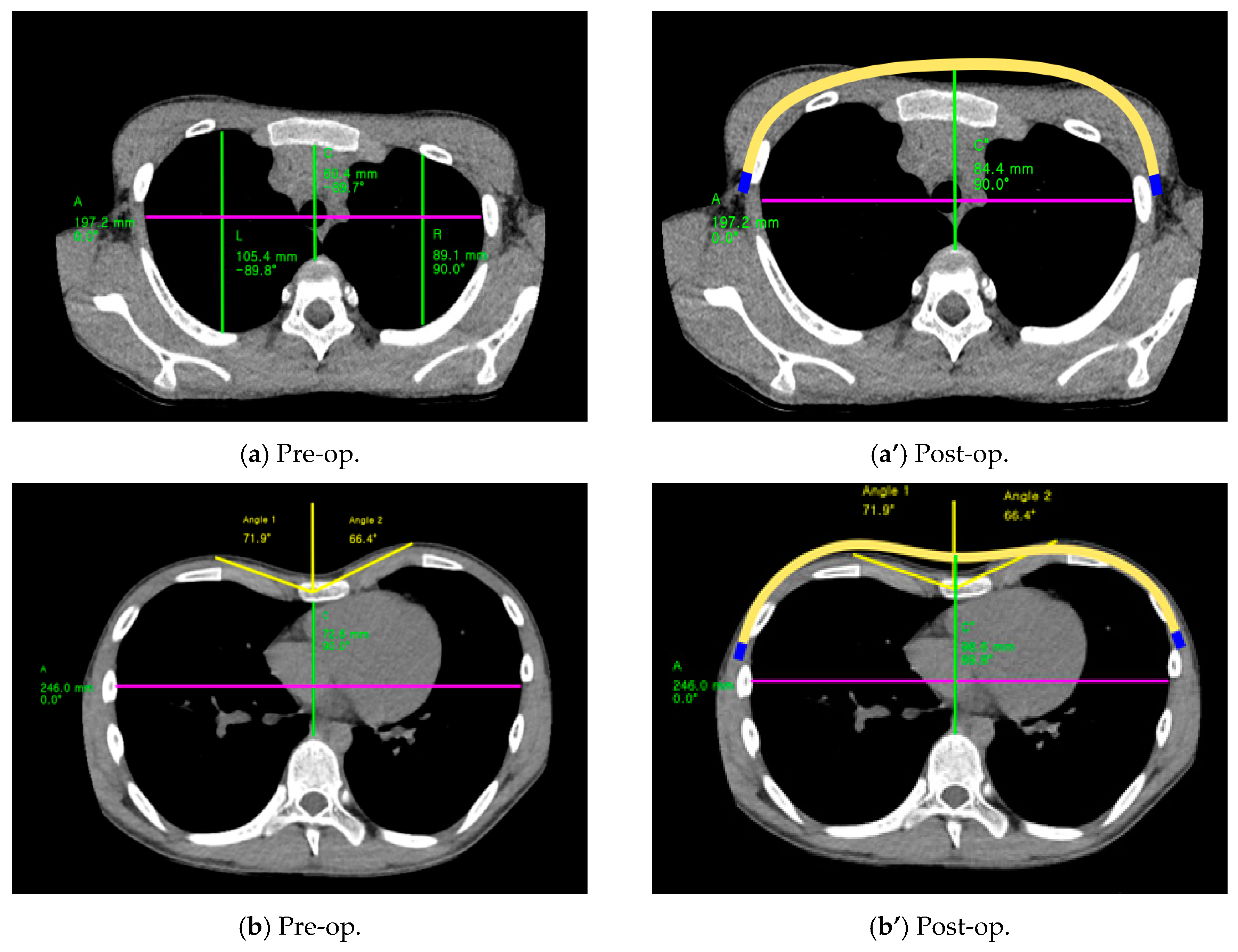 Applsci 09 00042 g012