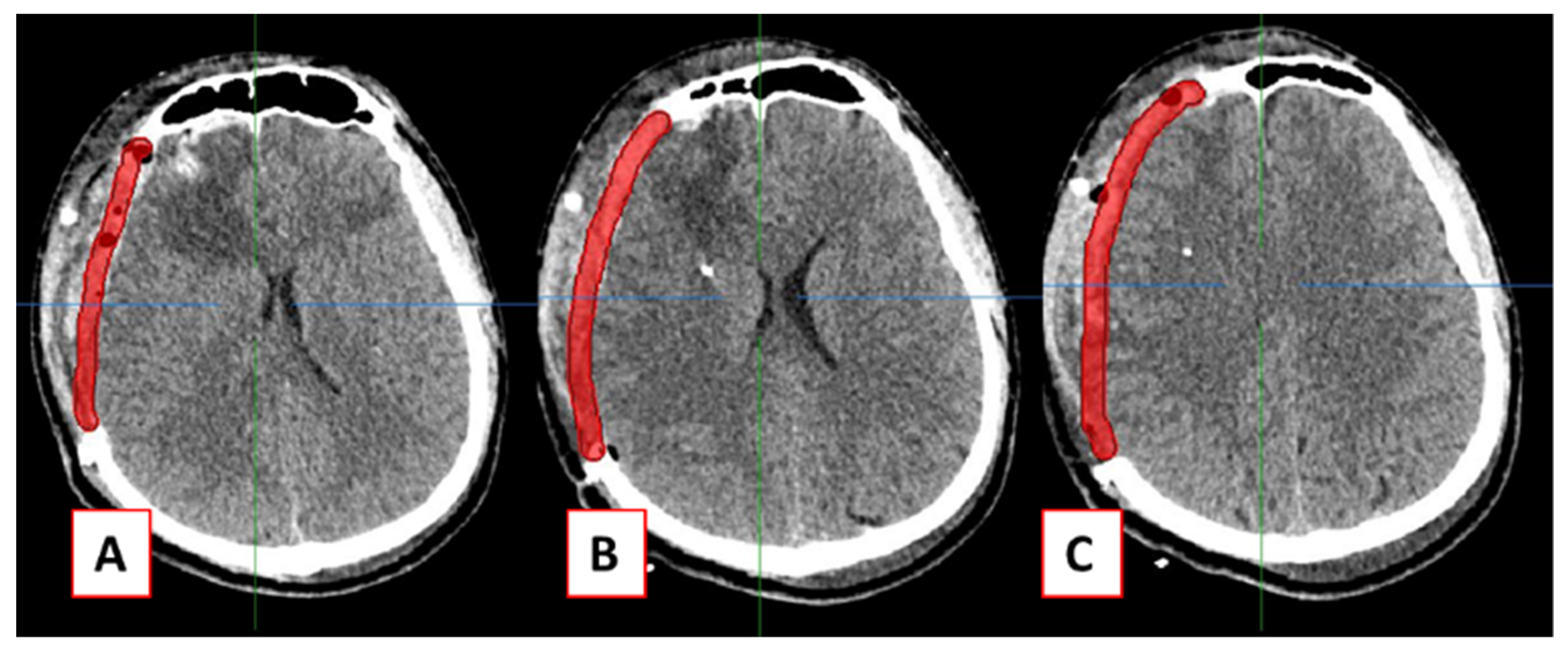 Applsci 11 07604 g004