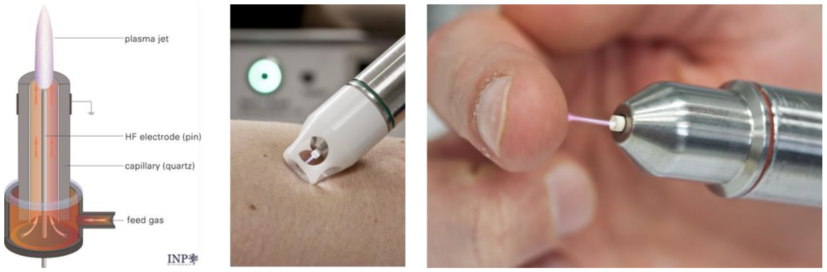 Applsci 12 03800 g006