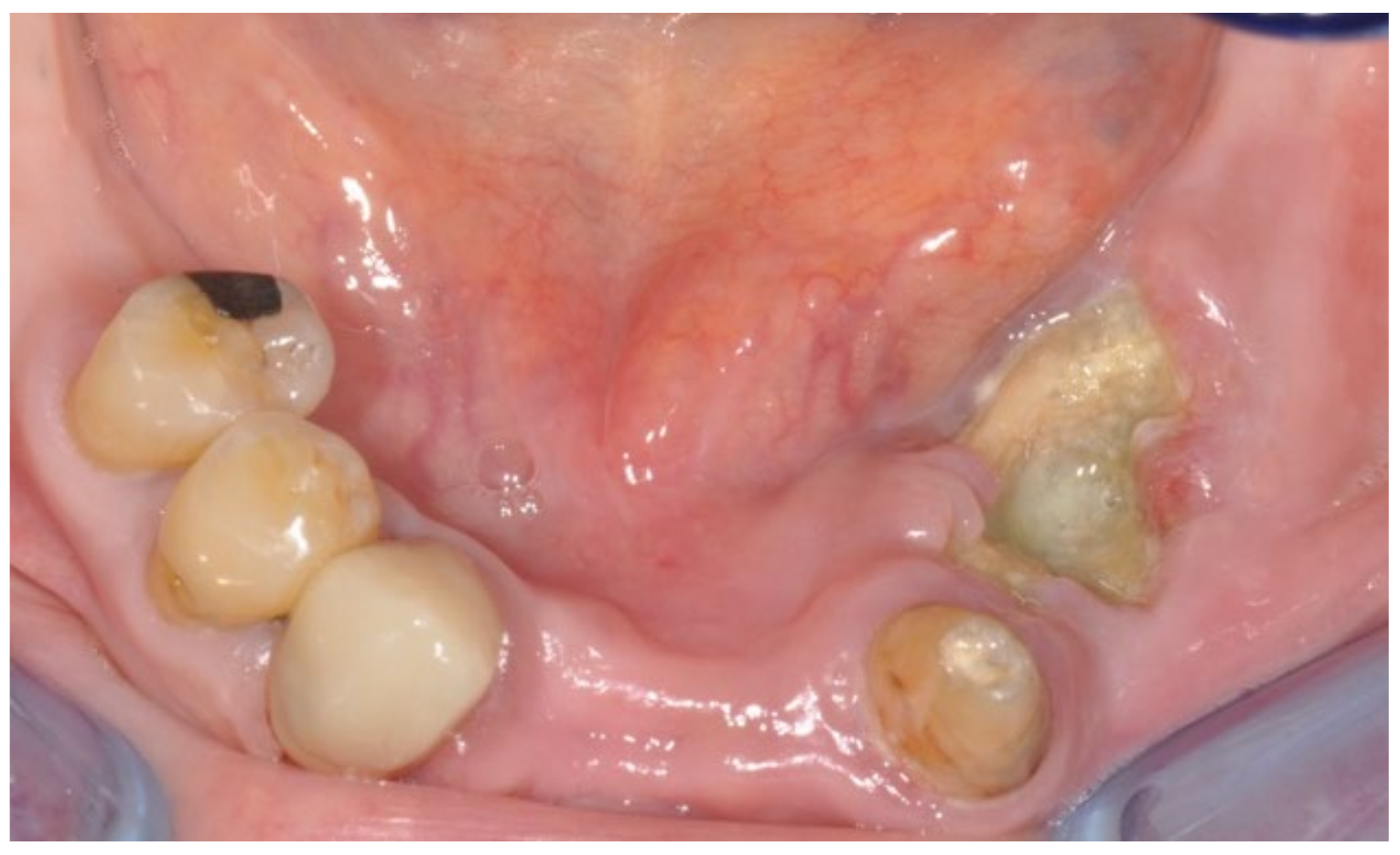 Bioengineering 10 00863 g007 Bioengineering 10 00863 g007