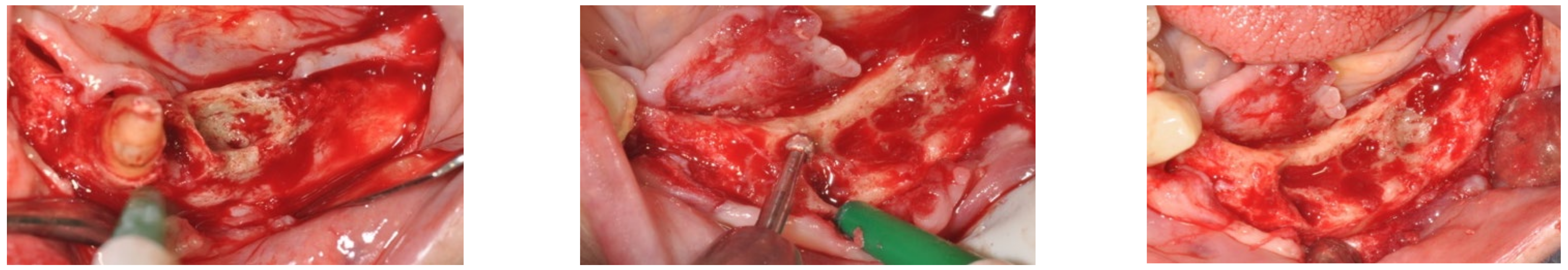 Bioengineering 10 00863 g008 Bioengineering 10 00863 g008