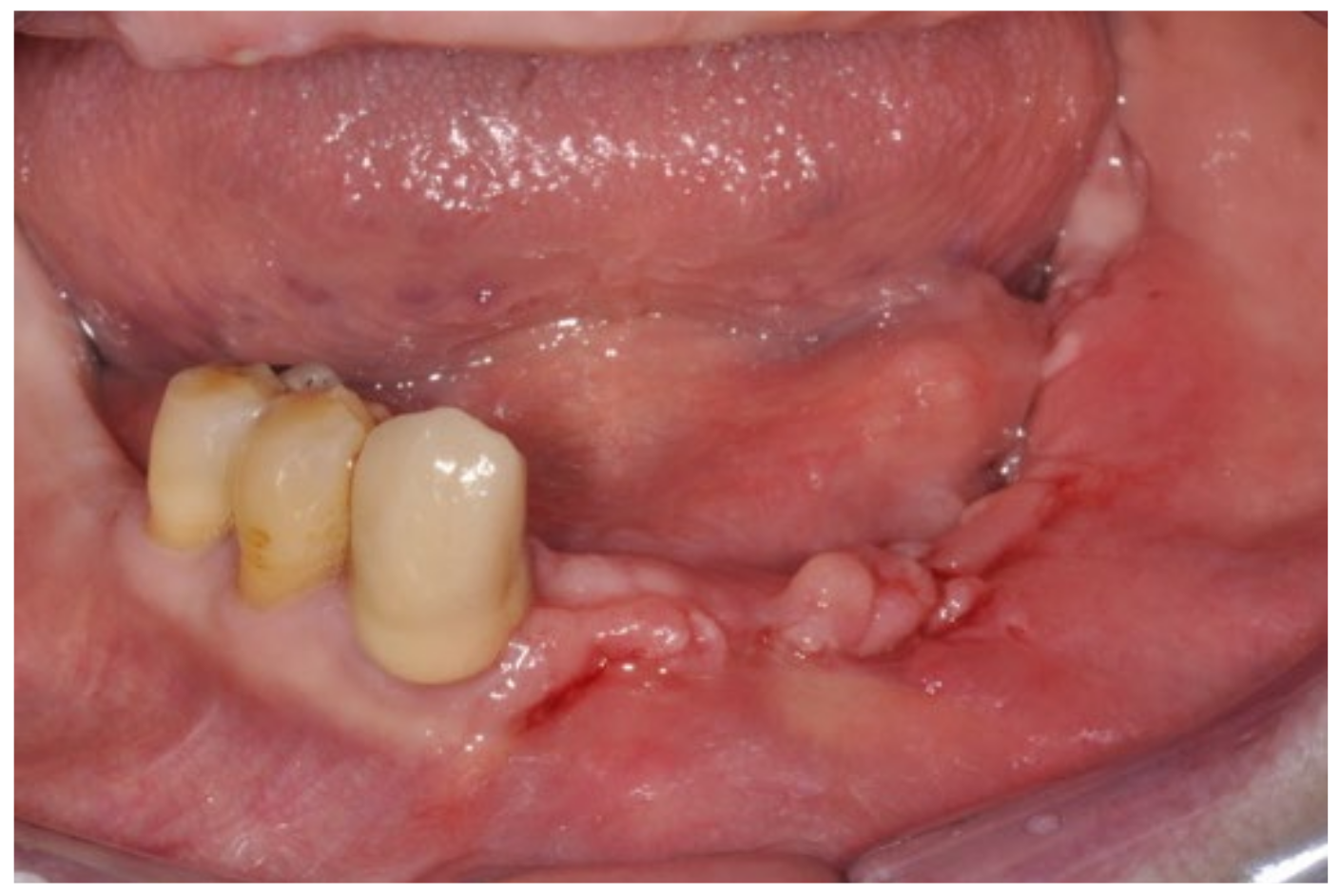 Bioengineering 10 00863 g009 Bioengineering 10 00863 g009