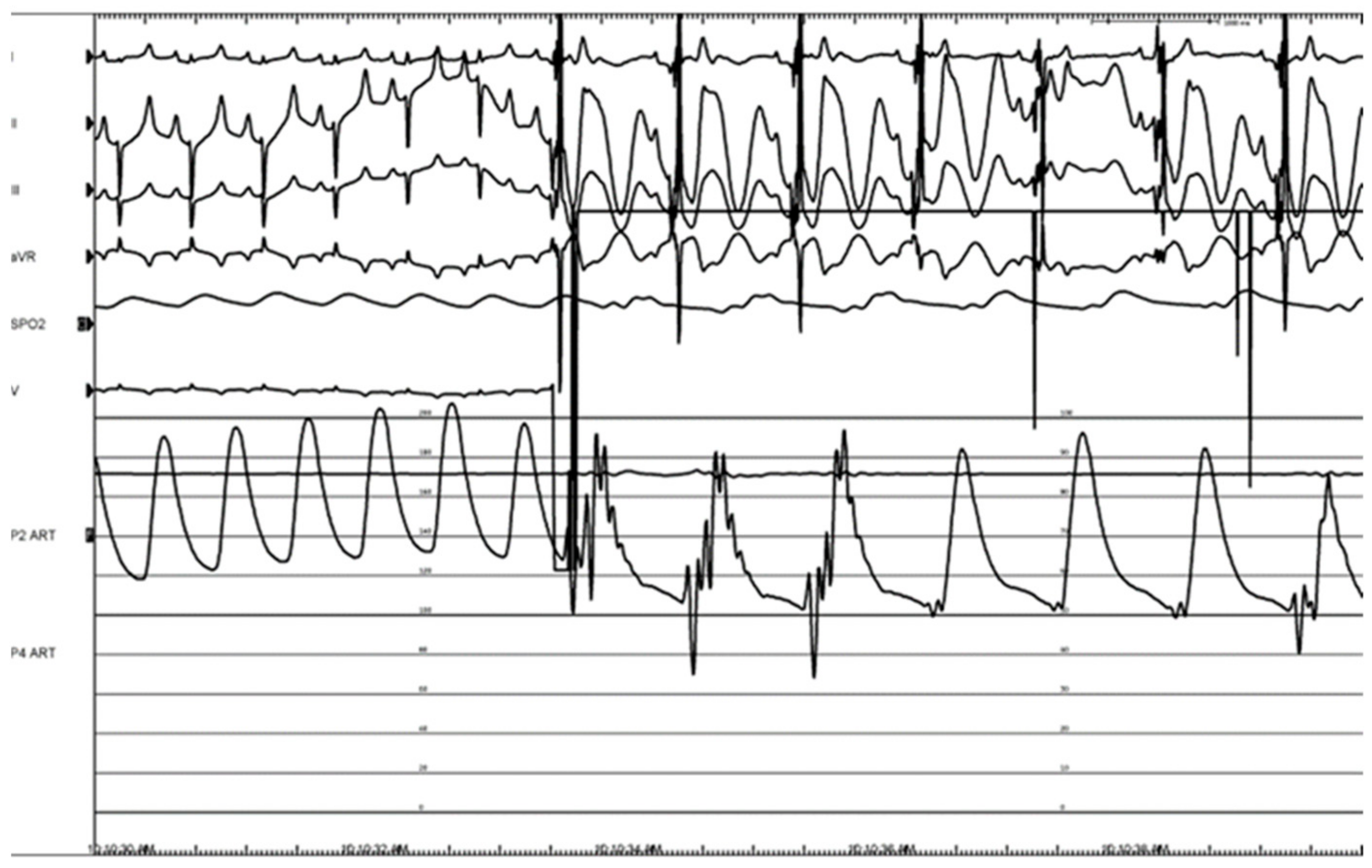 Bioengineering 11 00018 g015