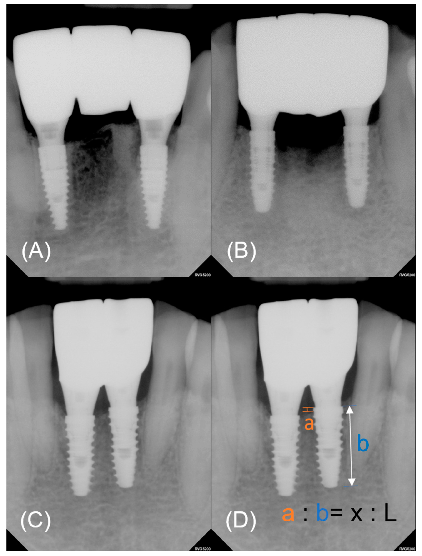 Bioengineering 11 00272 g003