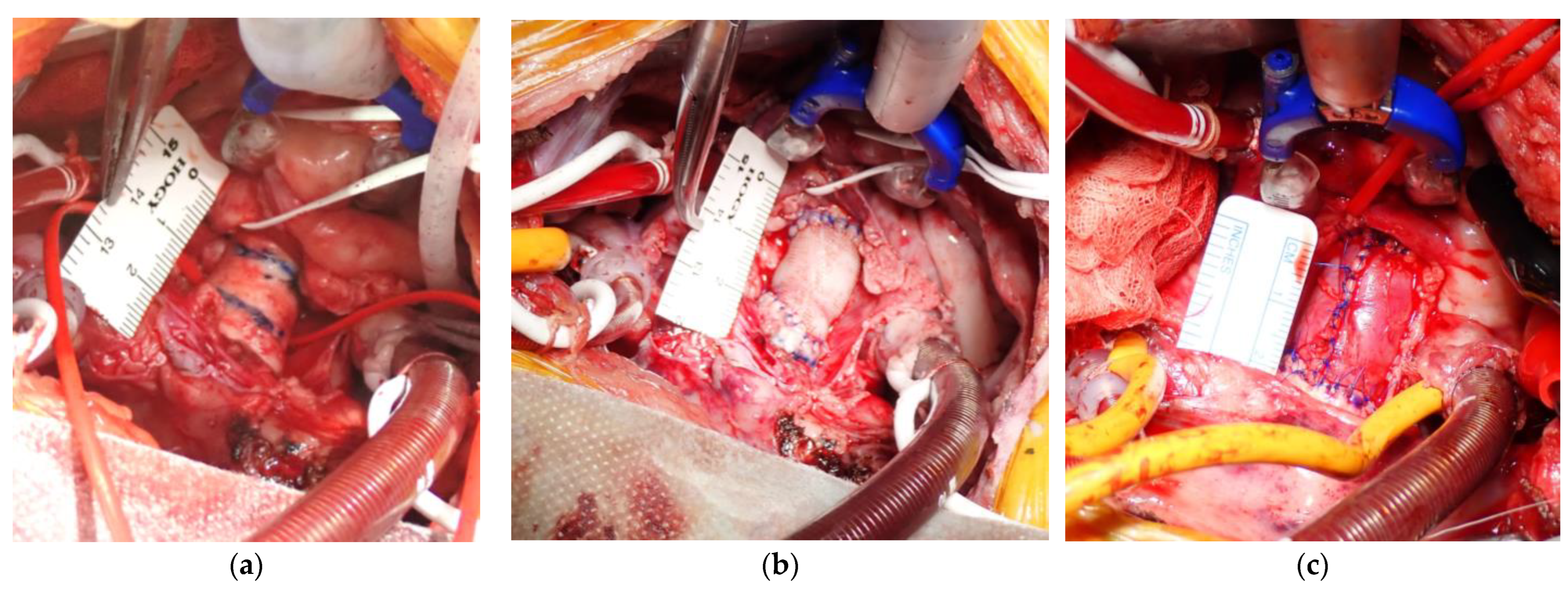 Bioengineering 11 00405 g002