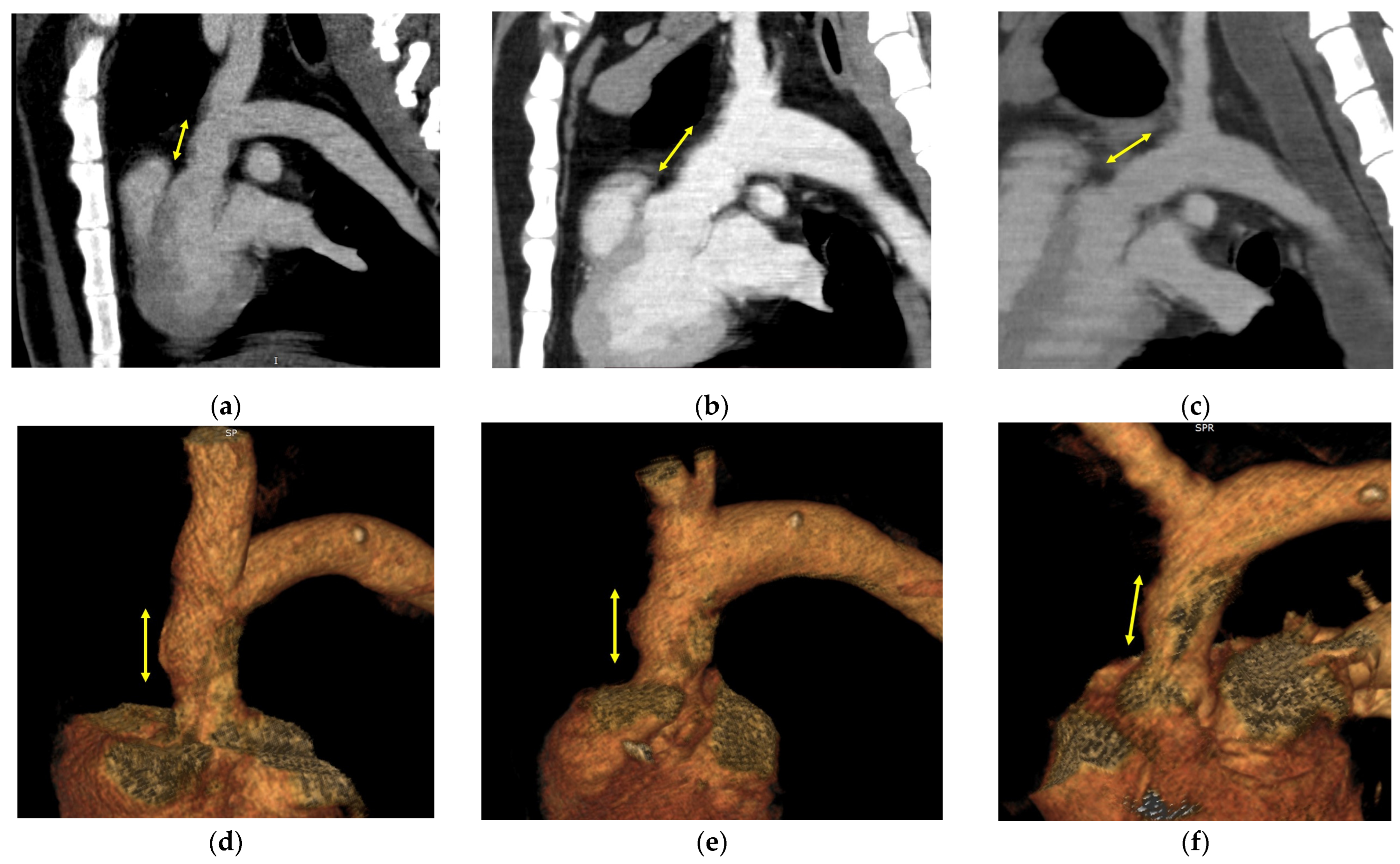 Bioengineering 11 00405 g003