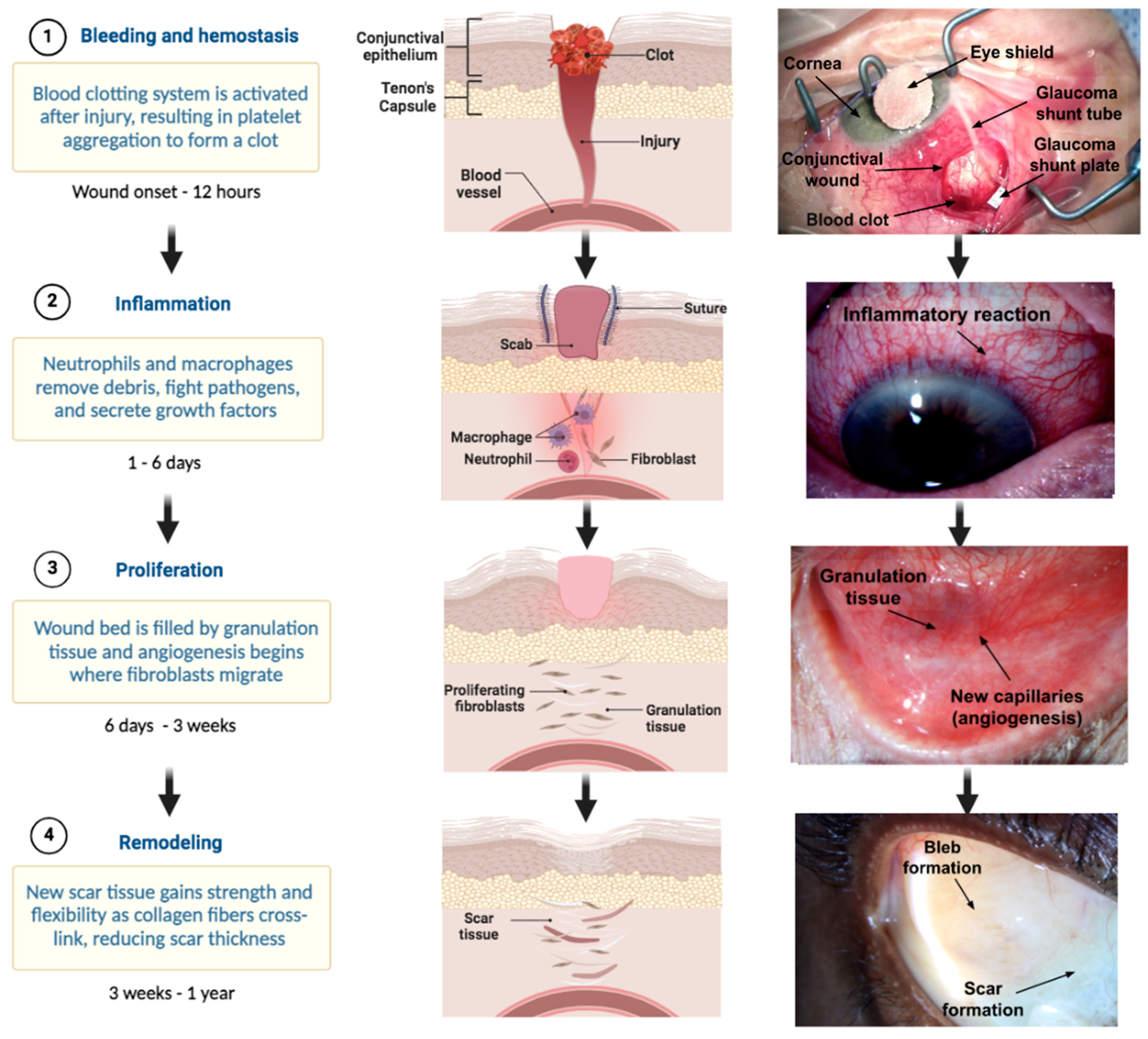 Bioengineering 11 00446 g003
