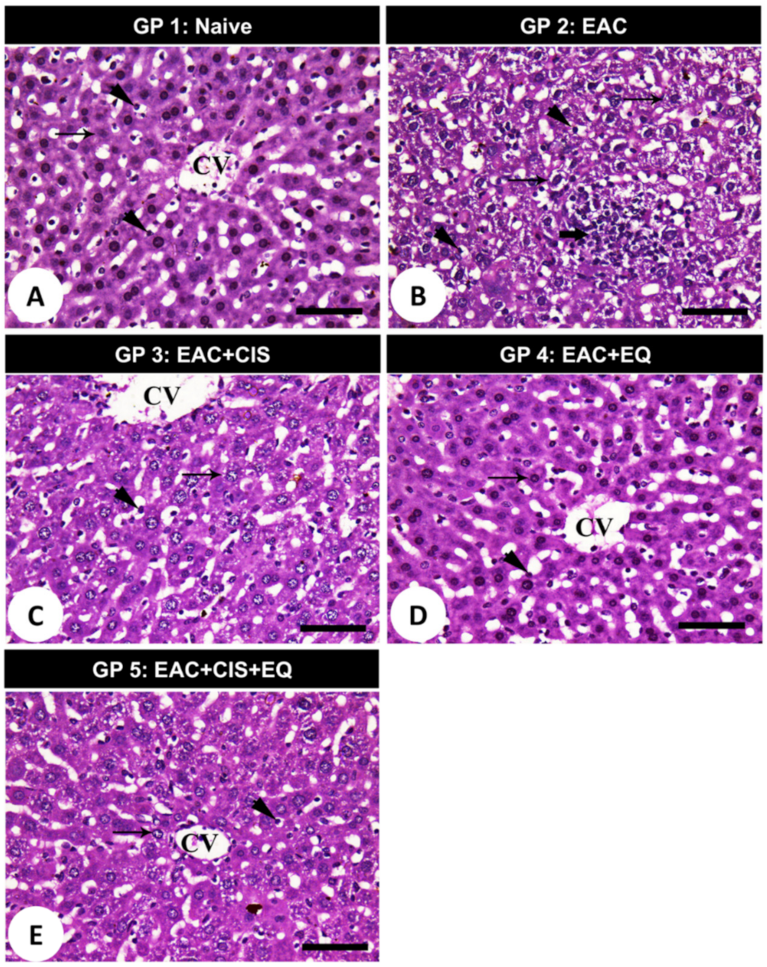 Biomedicines 09 01526 g006