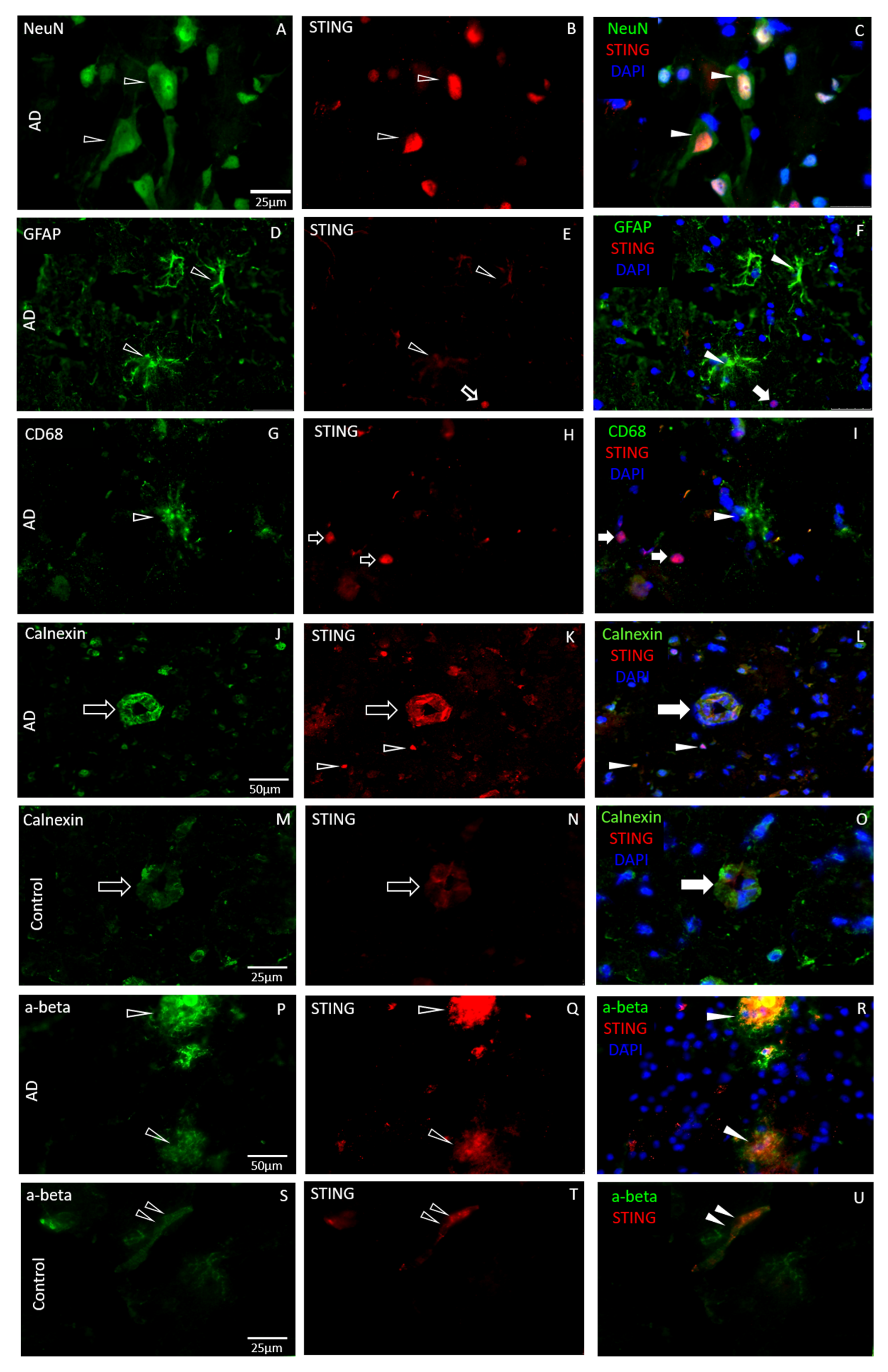 Biomedicines 11 01375 g003