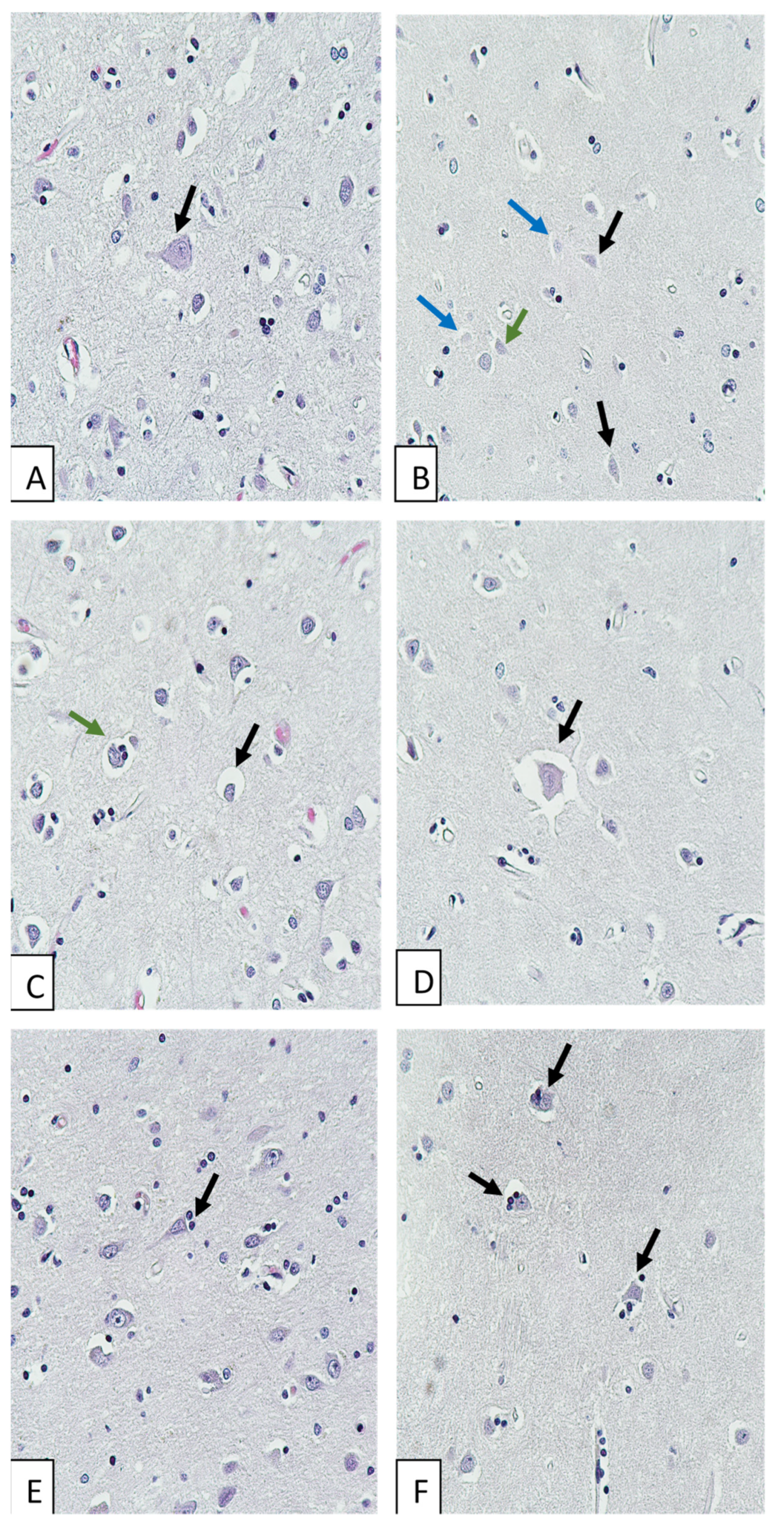 Biomedicines 11 01407 g001
