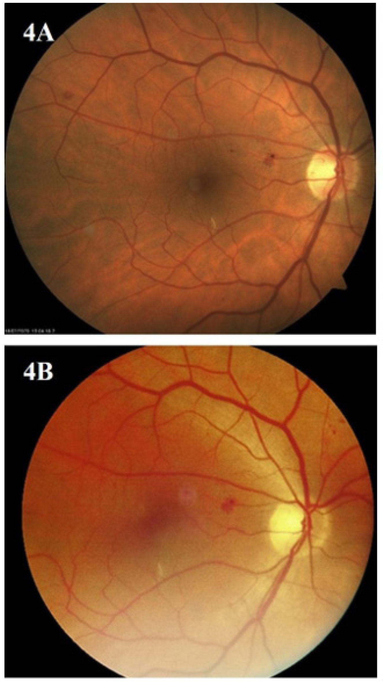 Biomedicines 12 00034 g004