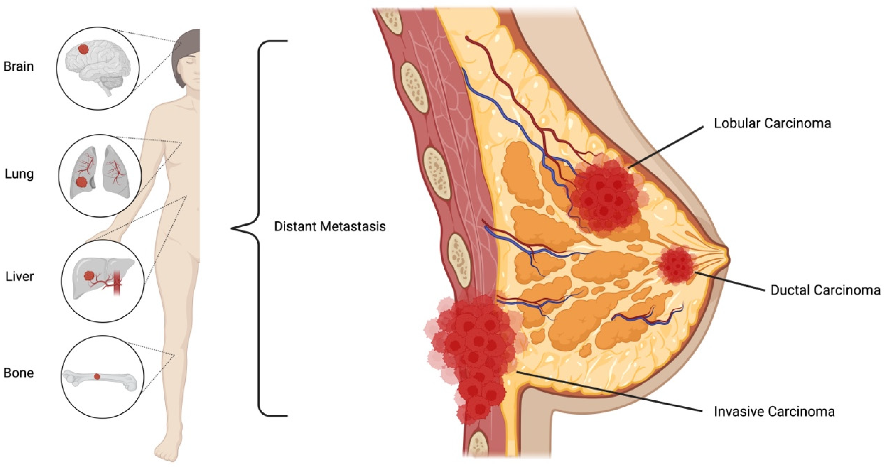 Biomedicines 12 00895 g001