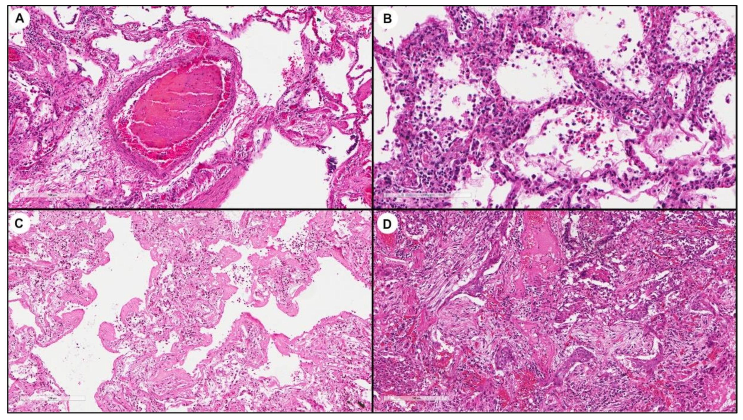 Biomolecules 11 00796 g005 Biomolecules 11 00796 g005