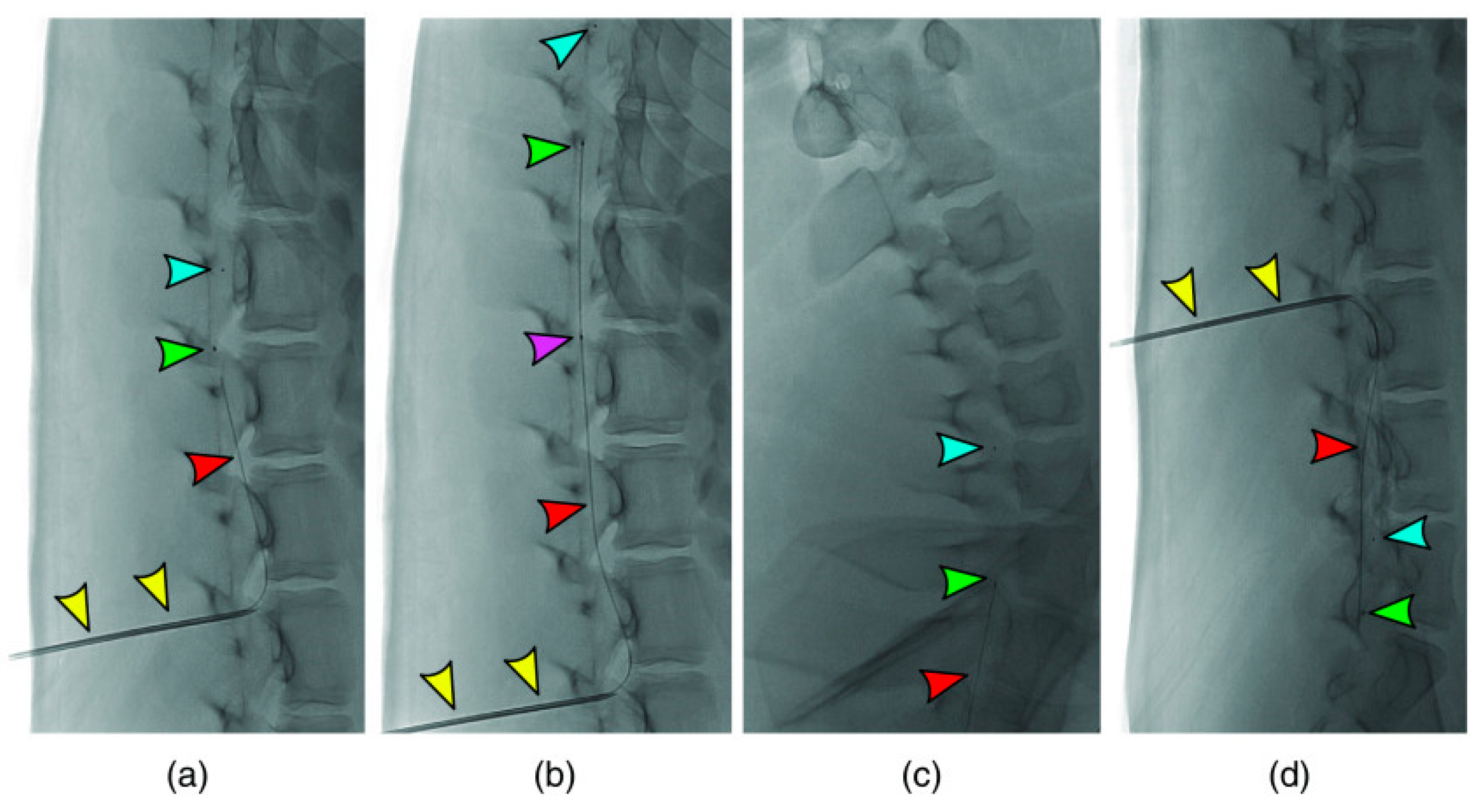 Biosensors 14 00296 g003