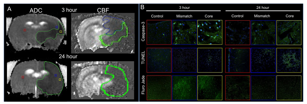 Brainsci 03 00540 g001 1024