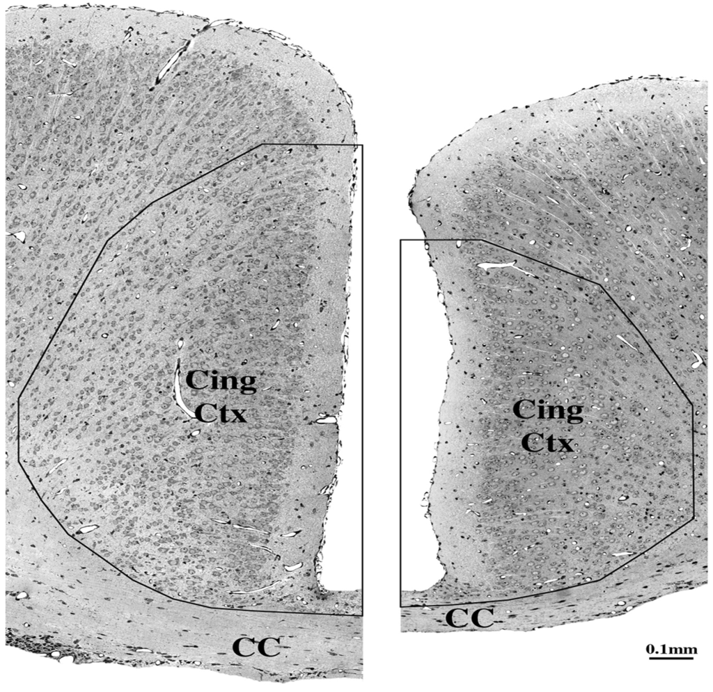 Brainsci 03 01153 g006 1024