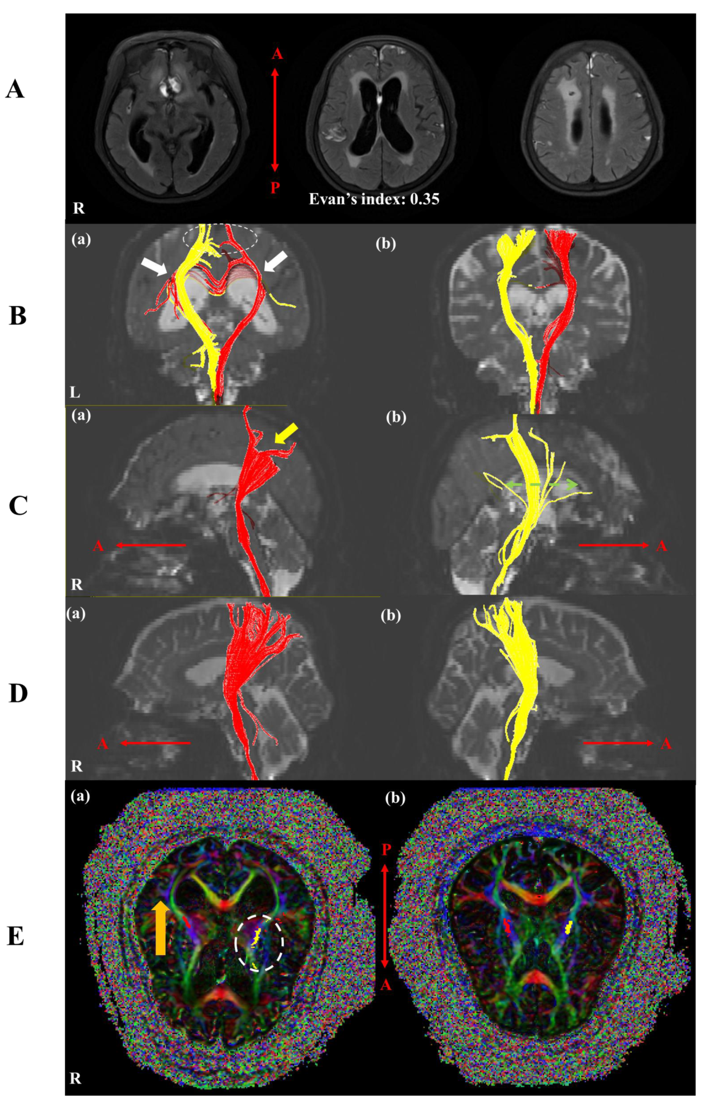 Brainsci 10 00177 g002