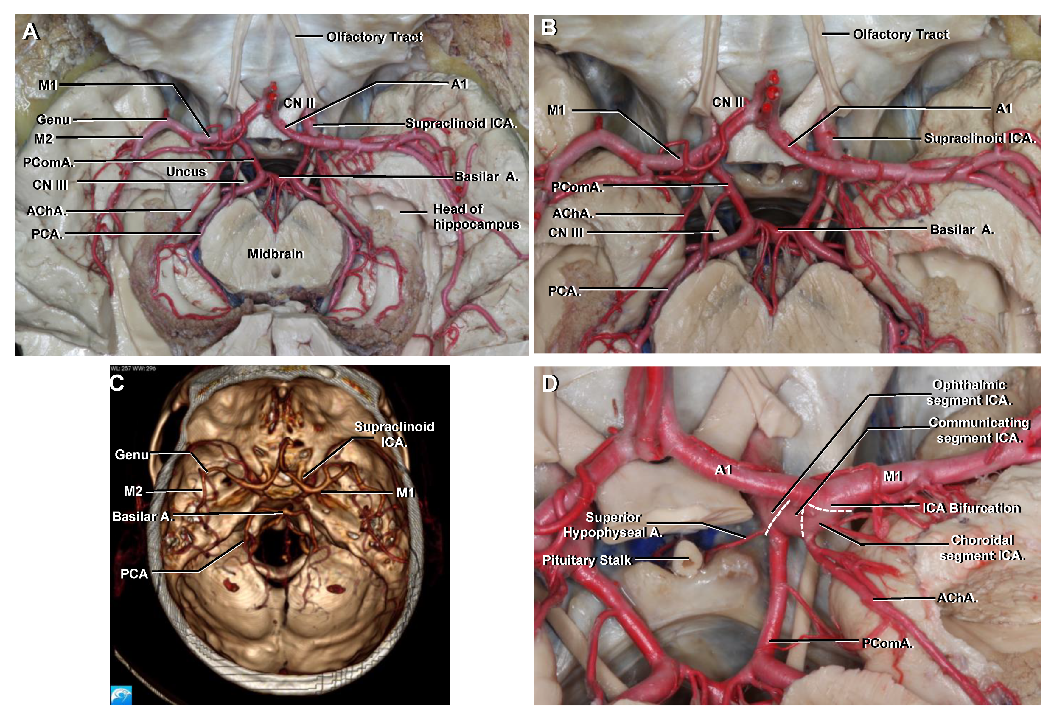 Brainsci 11 00519 g004