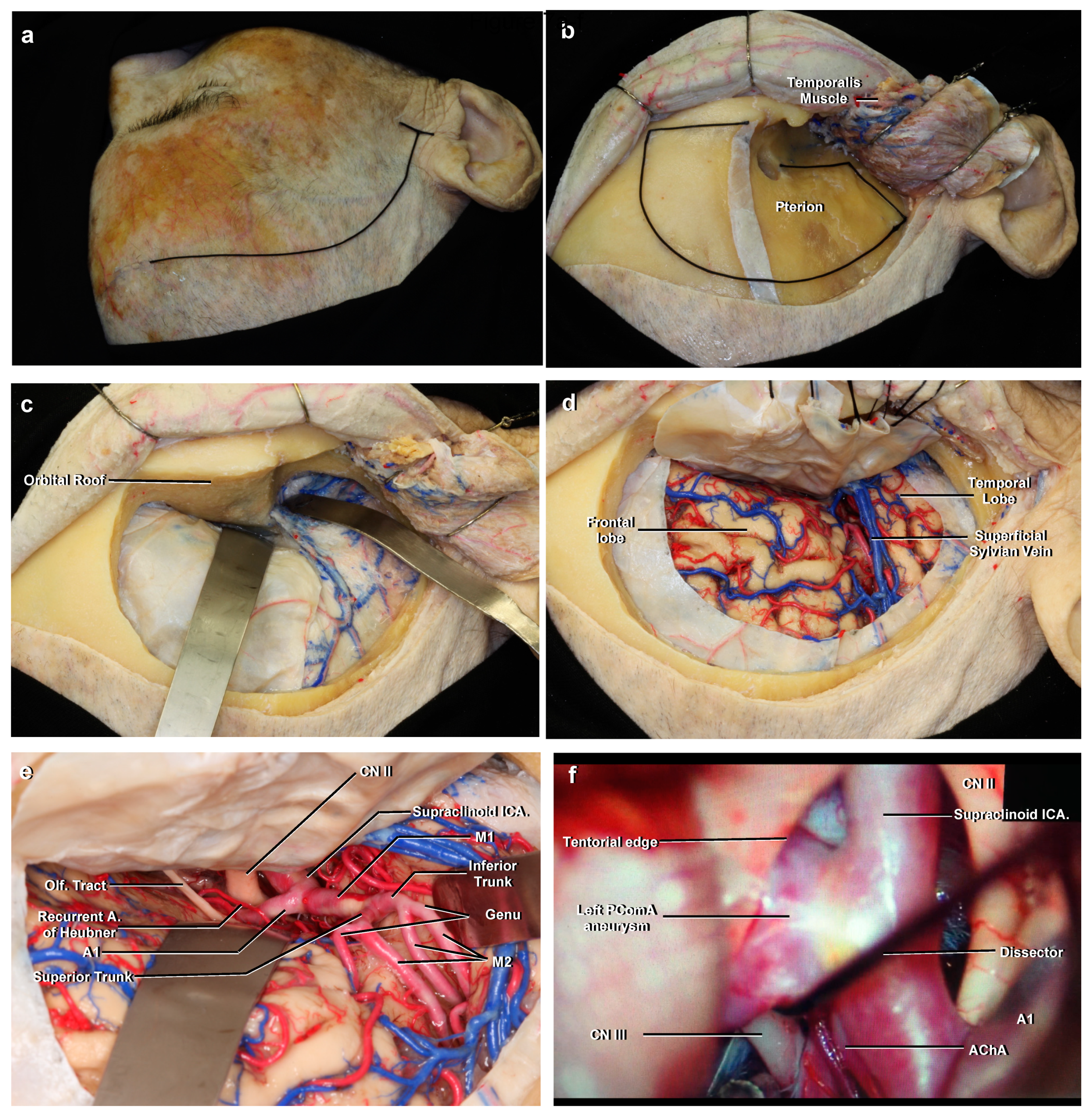 Brainsci 11 00519 g007