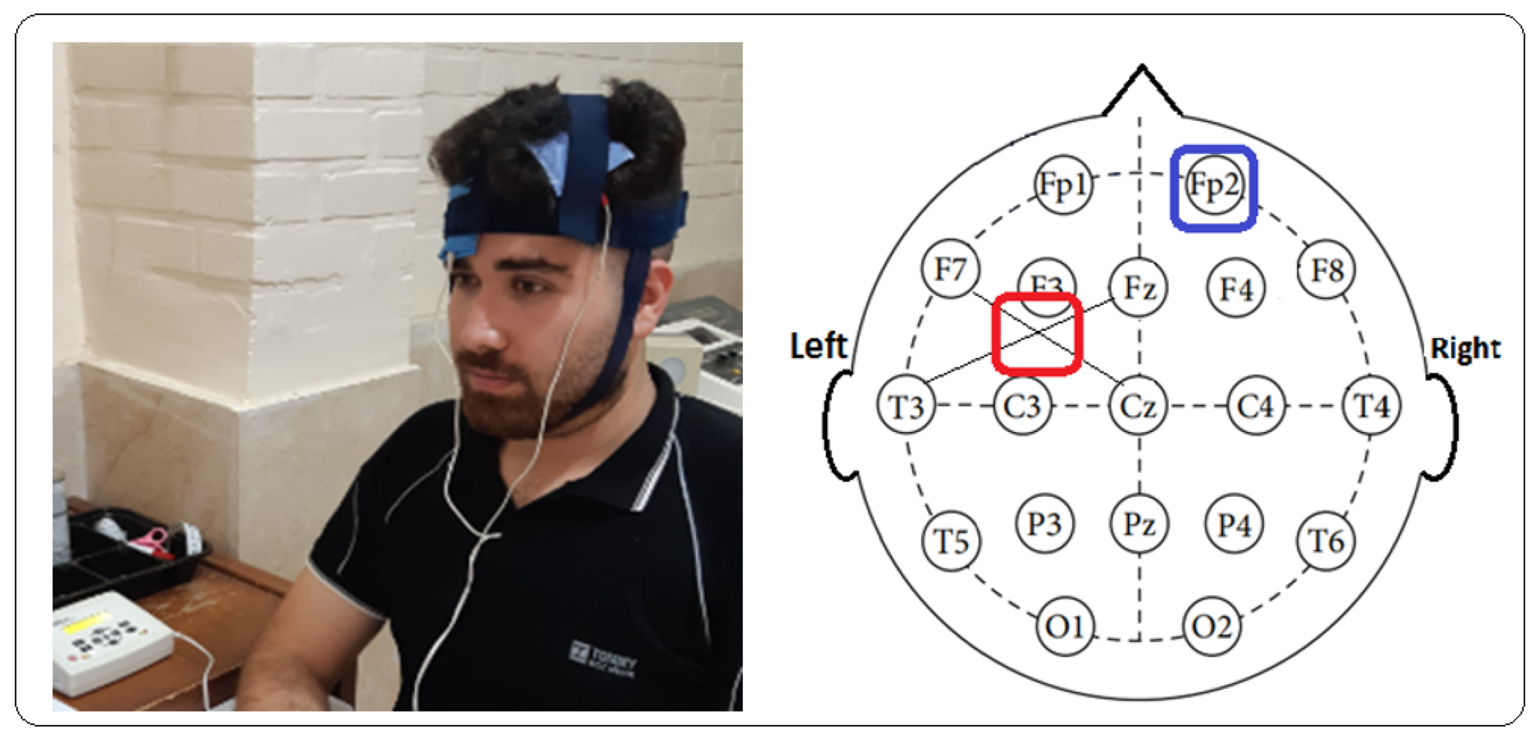 Brainsci 14 00477 g002