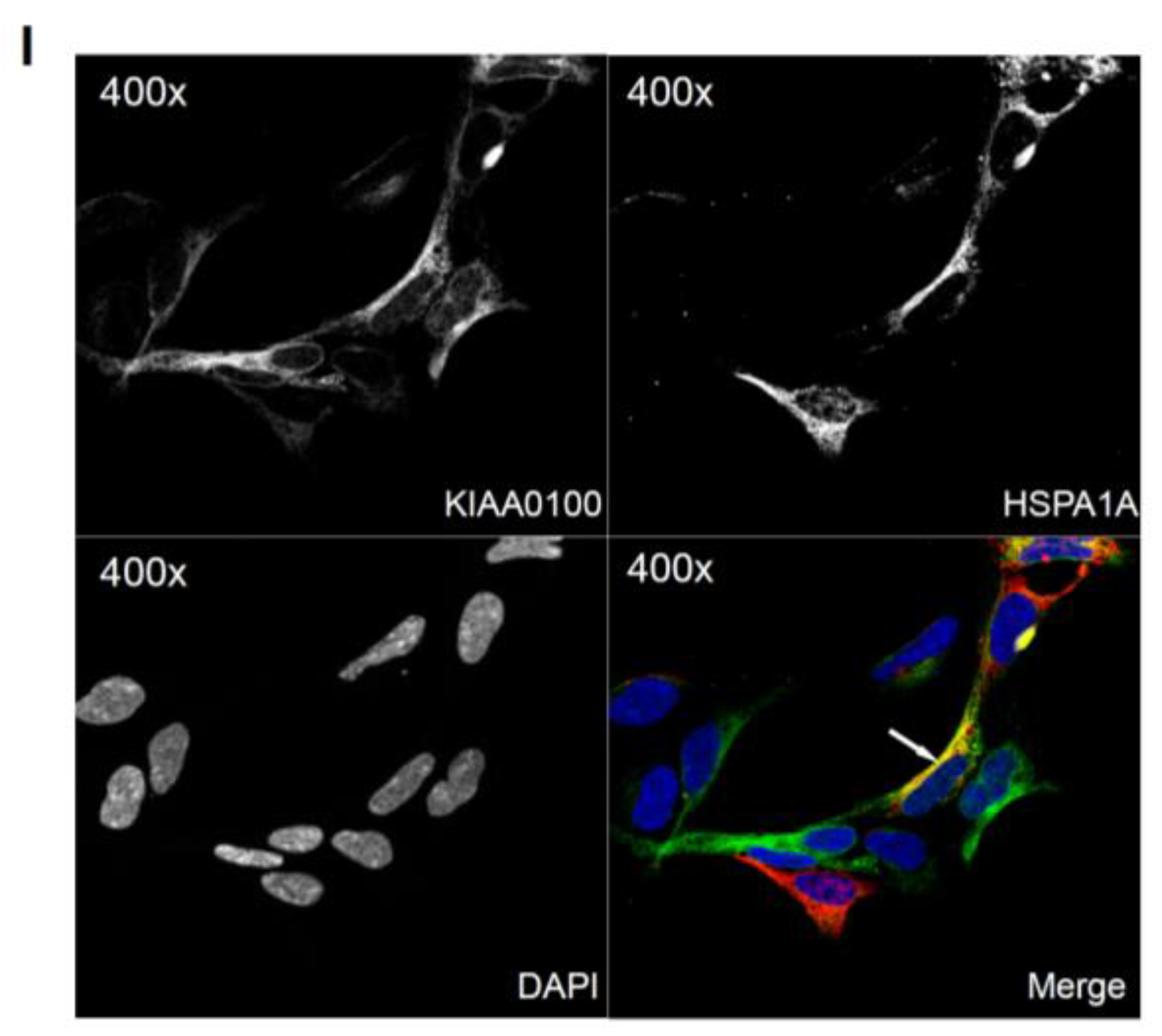 Cancers 10 00180 g006b