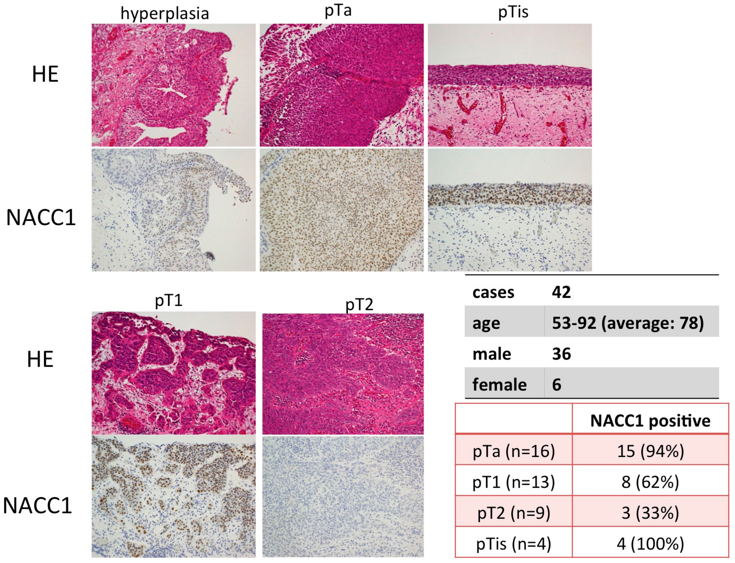 Cancers 10 00347 g001