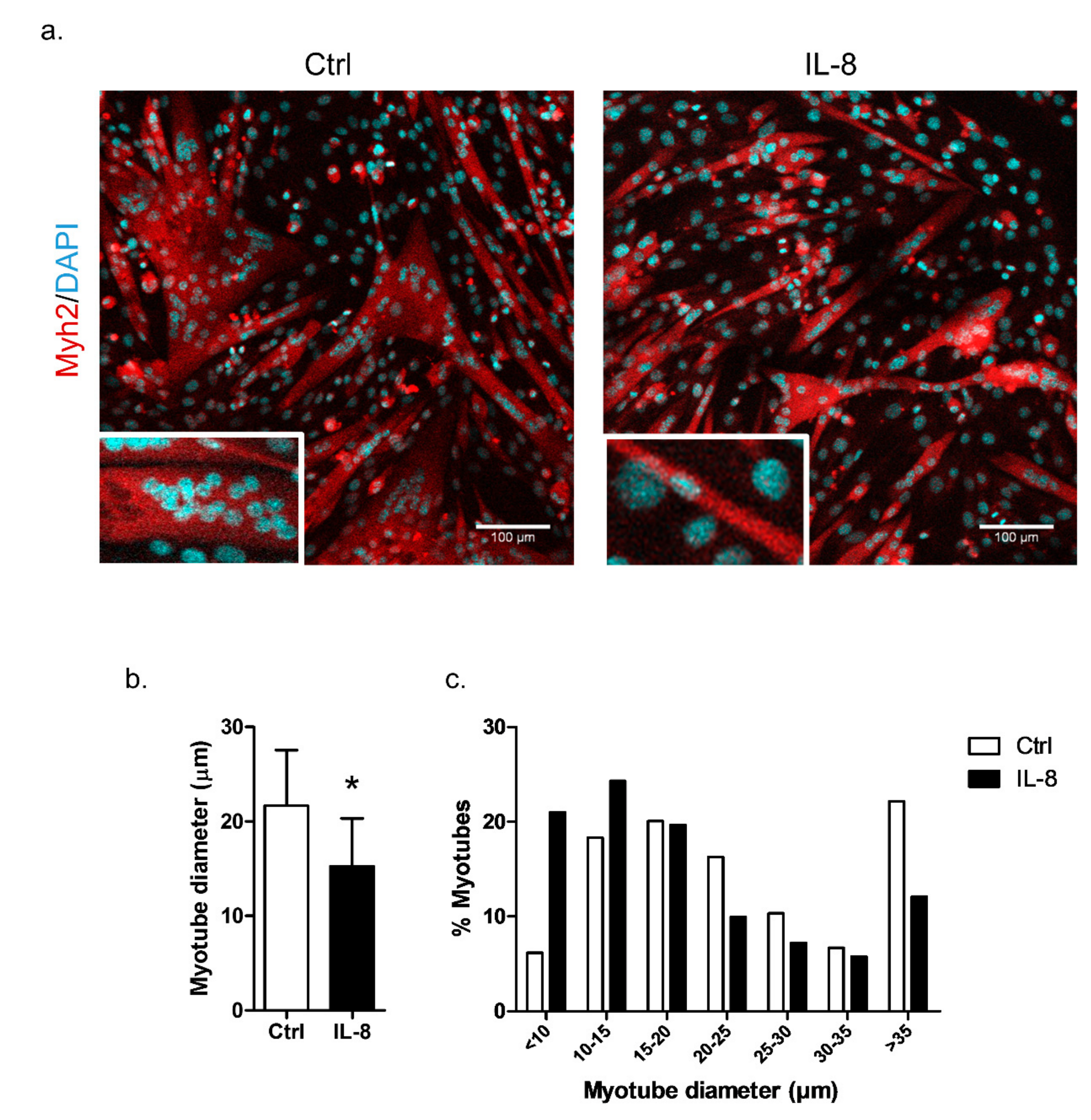 Cancers 11 01251 g006
