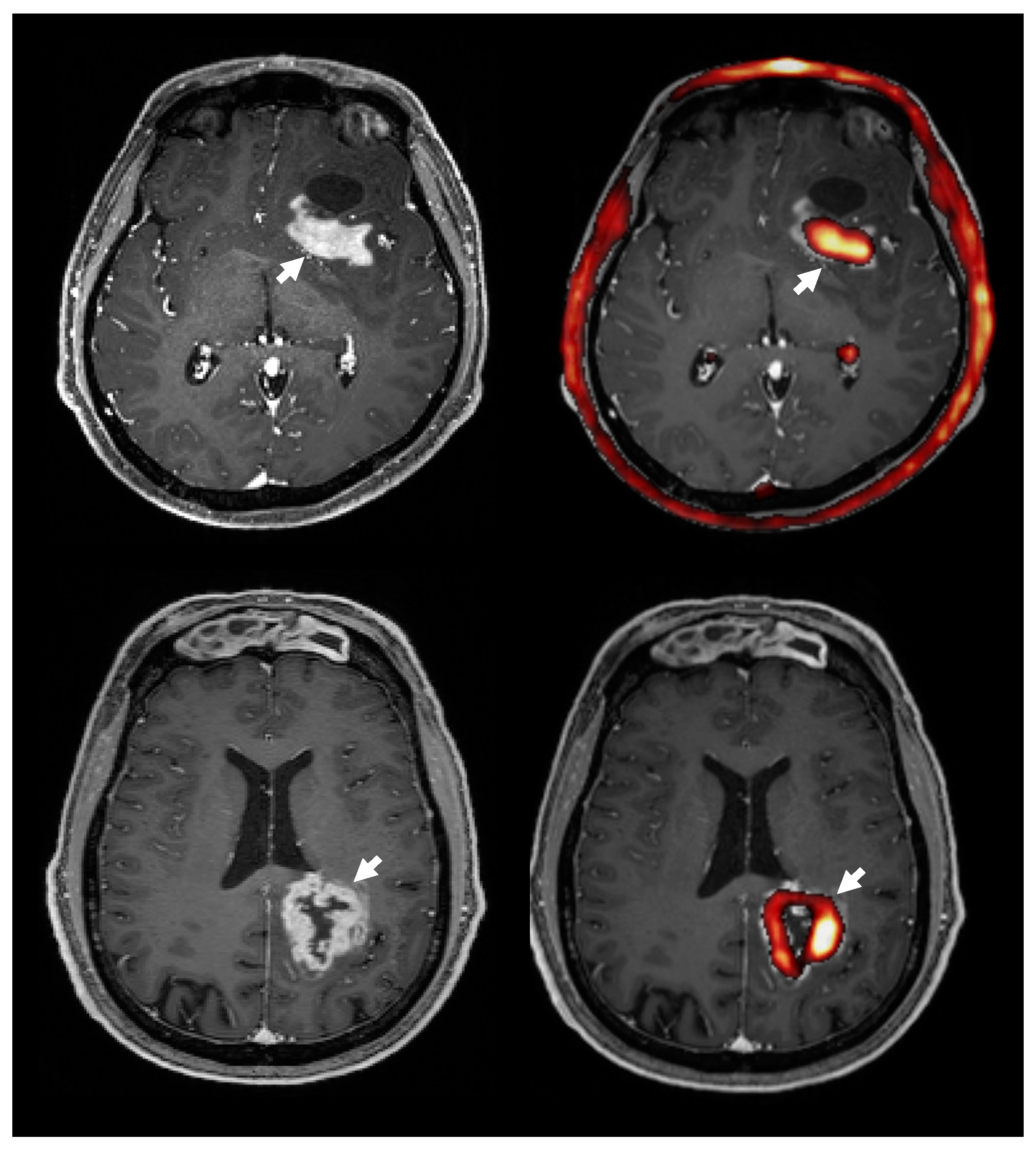 Cancers 11 01969 g005