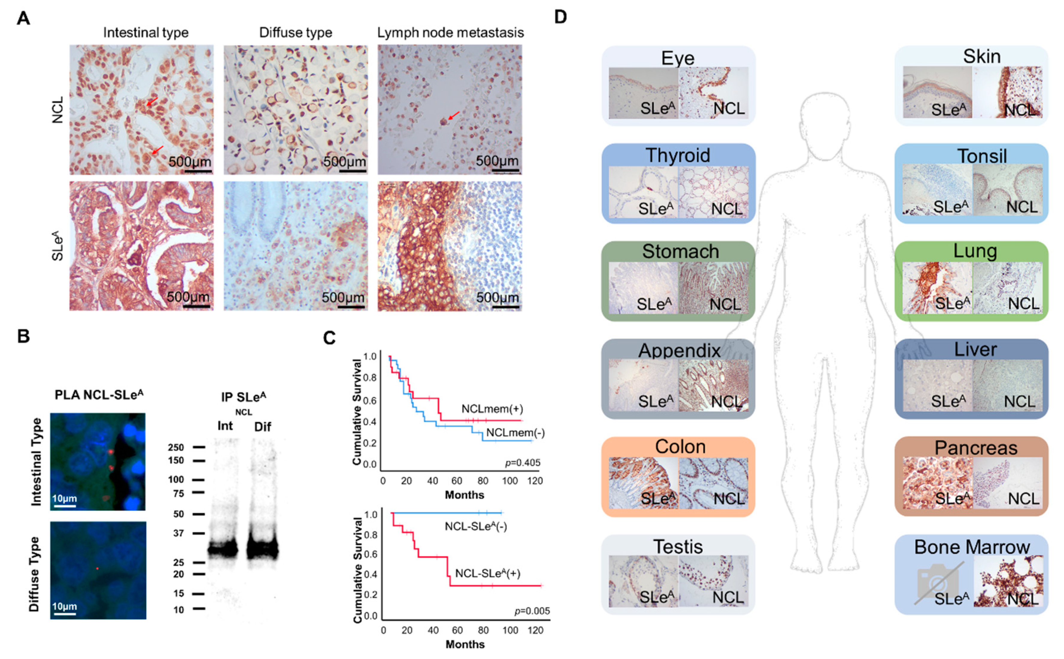 Cancers 12 00861 g006