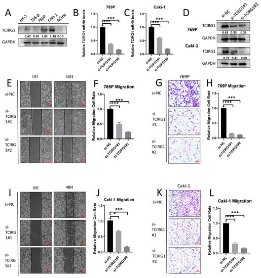 Cancers Free Full Text Integrative Analysis Identifies TCIRG1 As A