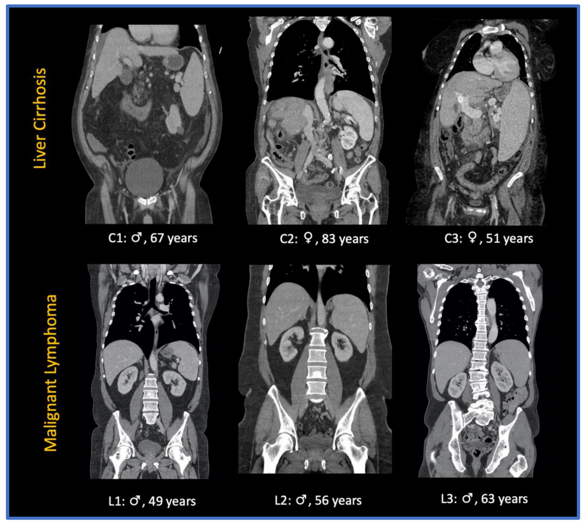 Cancers 14 05476 g002 Cancers 14 05476 g002