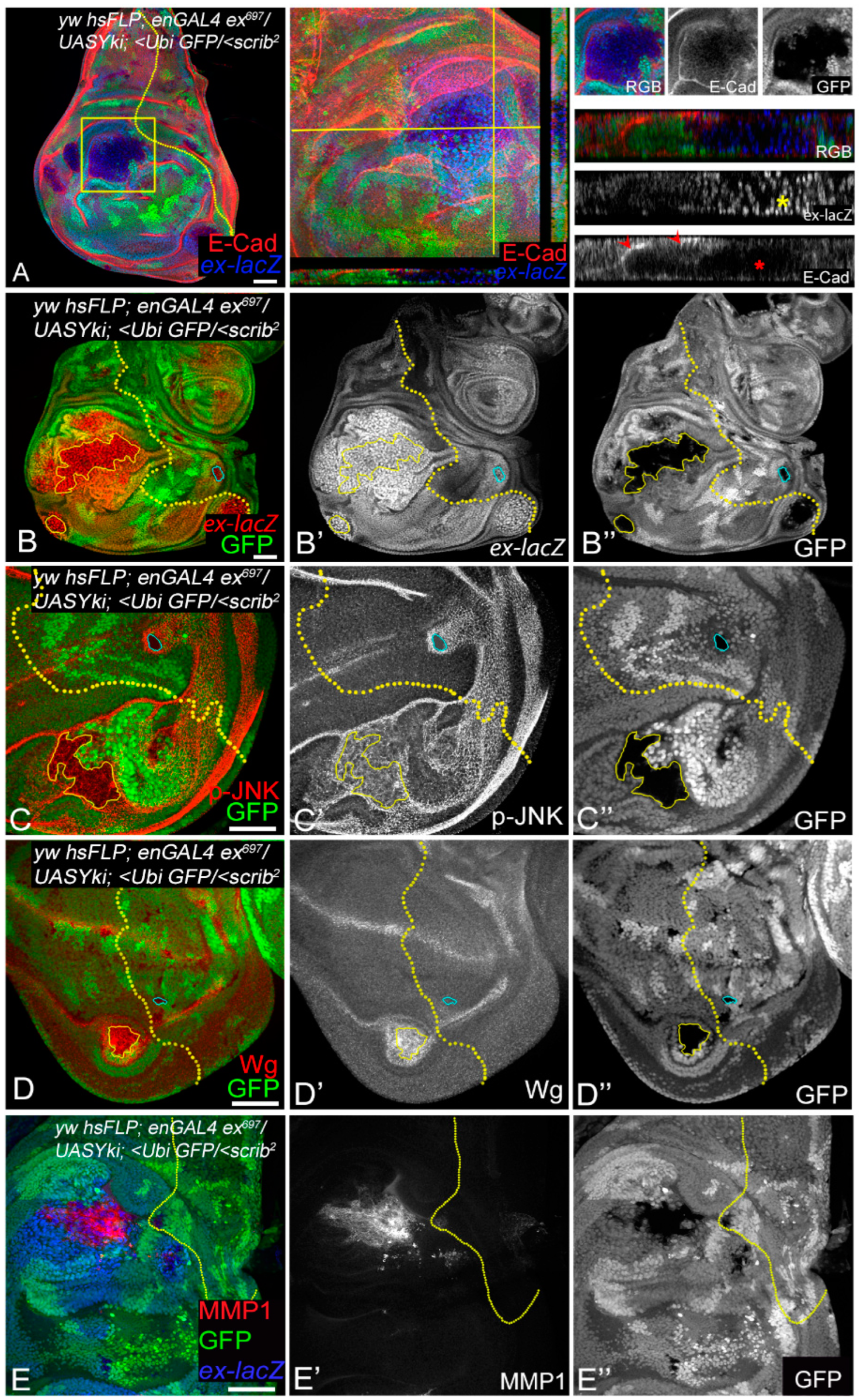 Cancers 16 01768 g005