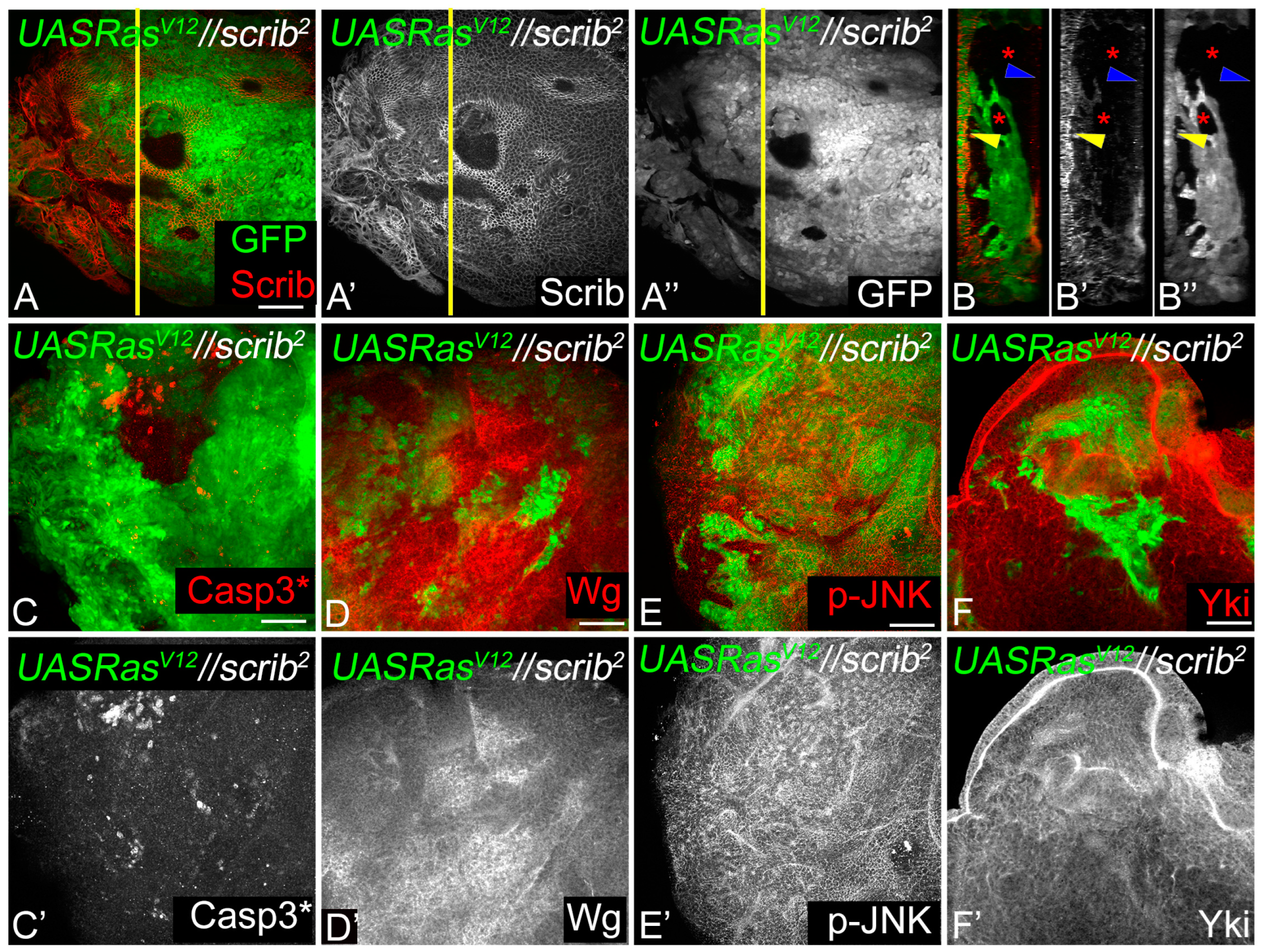 Cancers 16 01768 g006