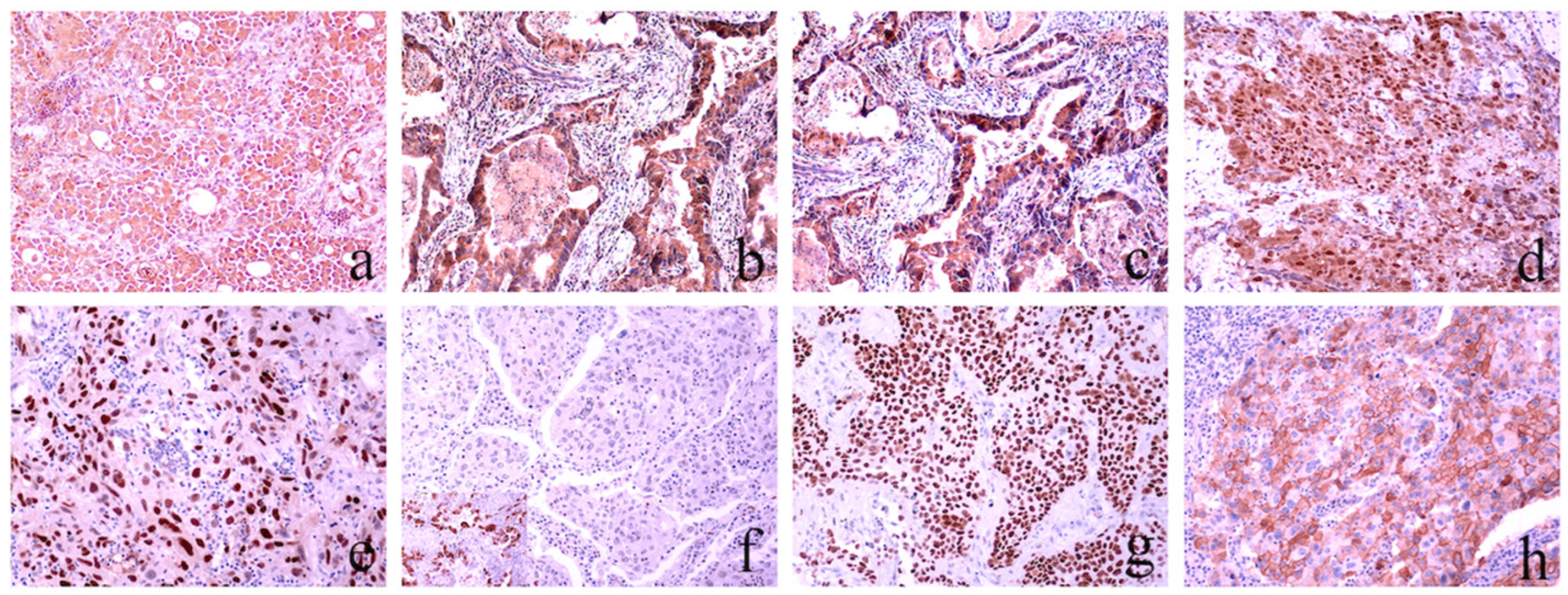 Cancers 16 01818 g003