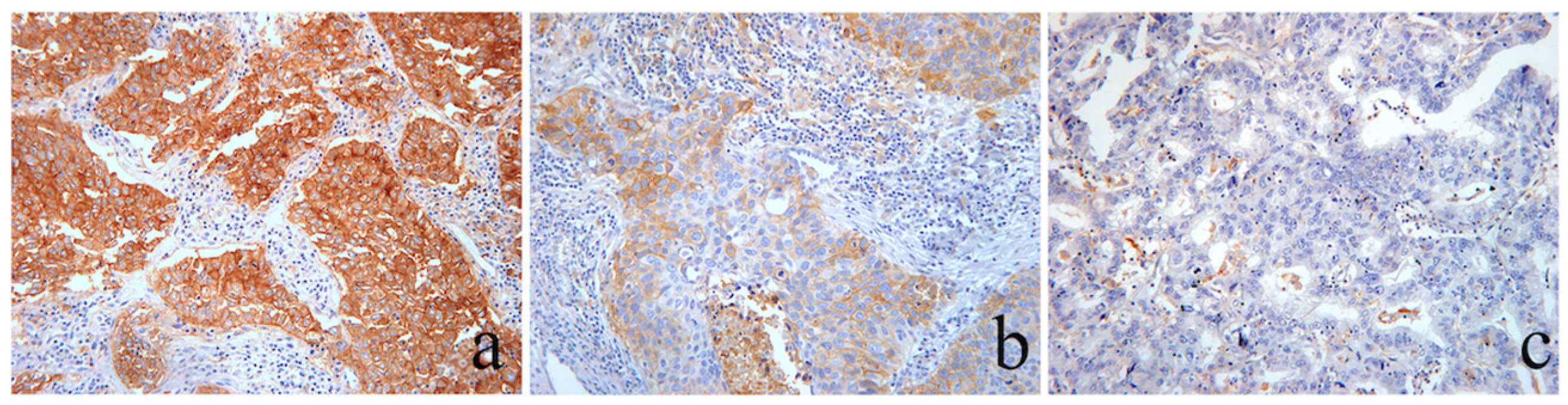 Cancers 16 01818 g004