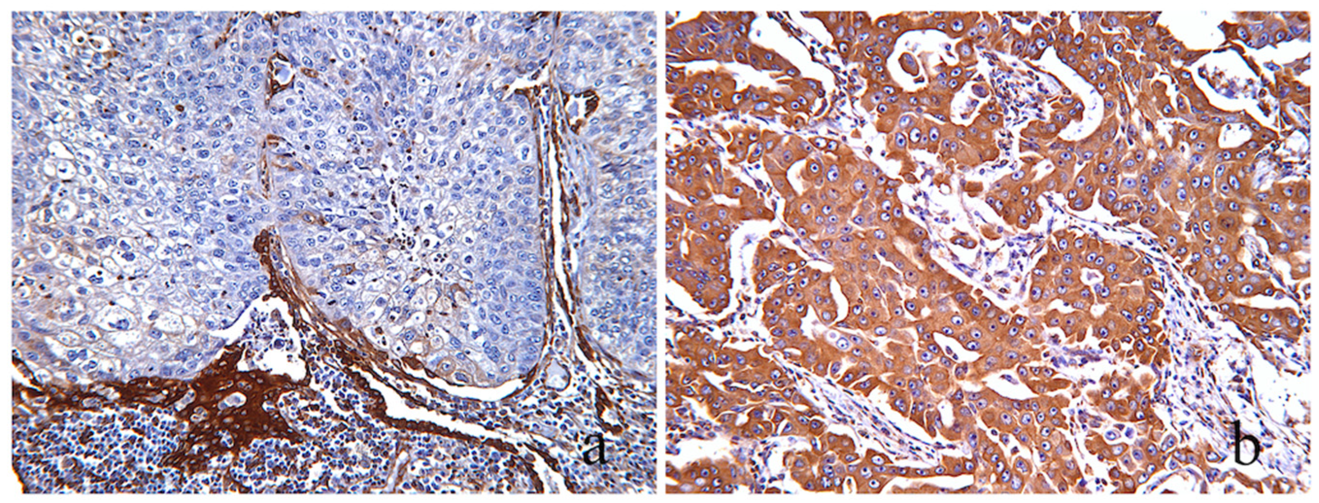 Cancers 16 01818 g005