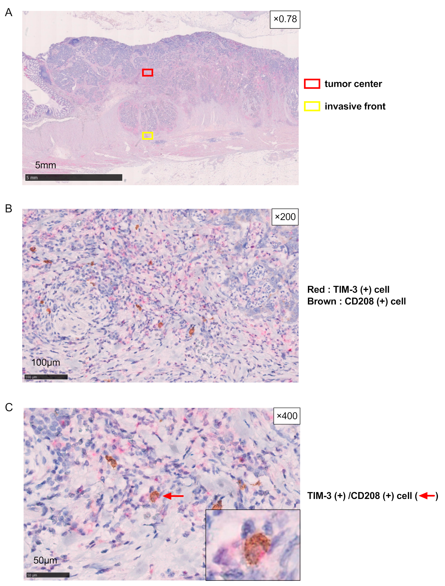 Cancers 16 01888 g002
