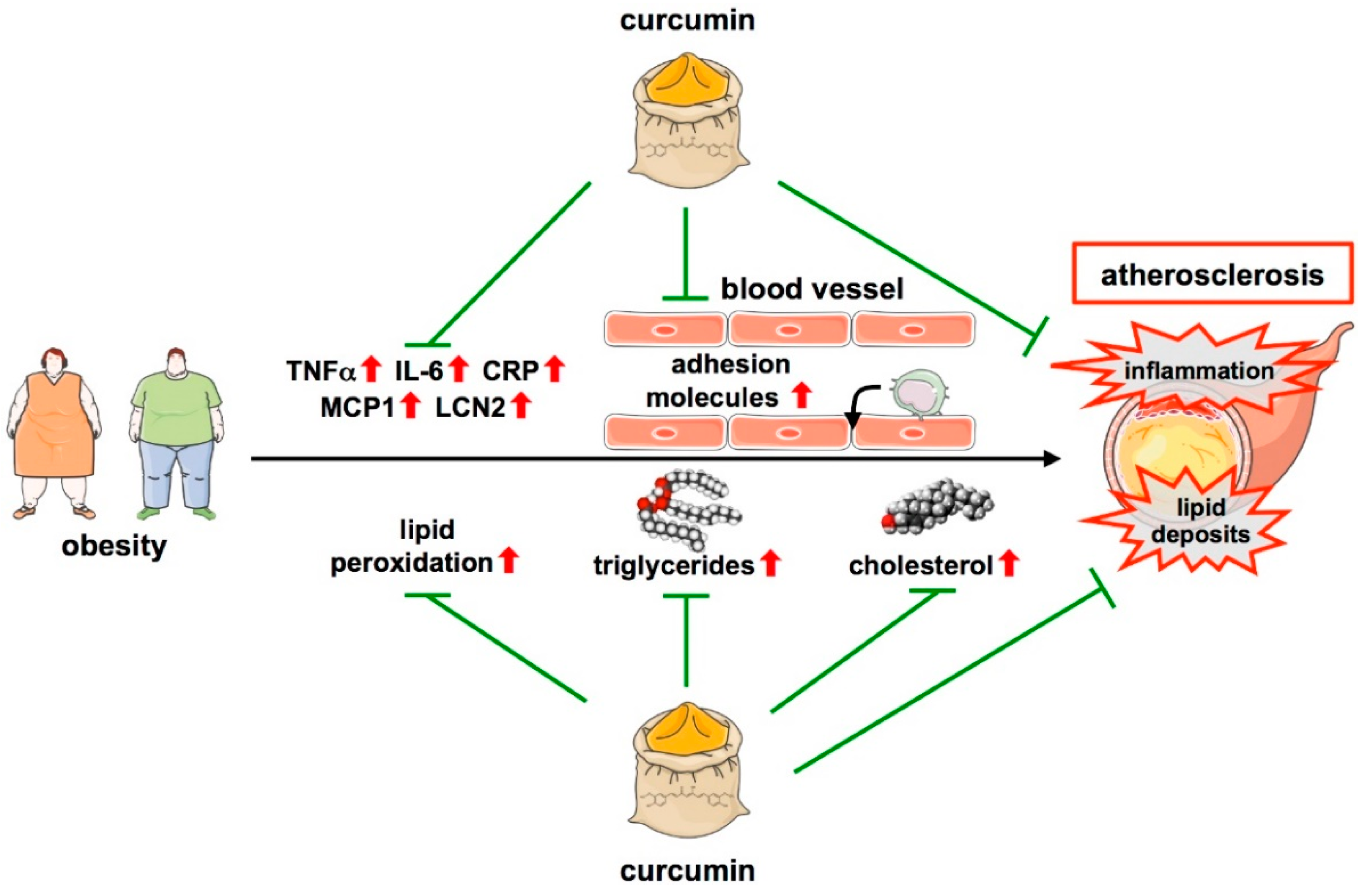 Cells Free Full Text Protective Effects Of Curcumin In