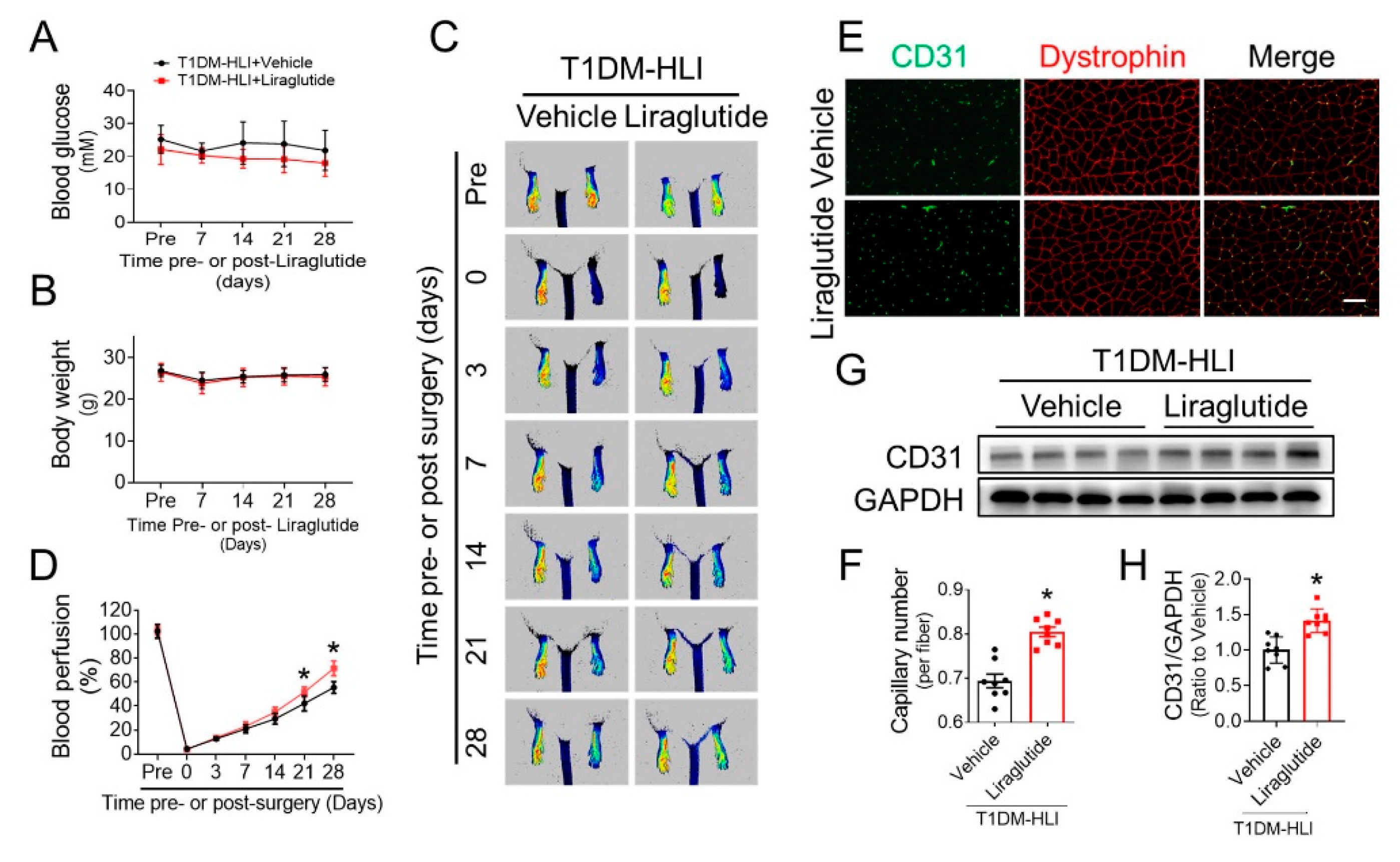 Cells Free Full Text Liraglutide Improves The Angiogenic Capability