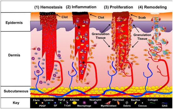 Negative Pressure Wound Therapy in Maxillofacial Applications Negative Pressure Wound Therapy in Maxillofacial Applications