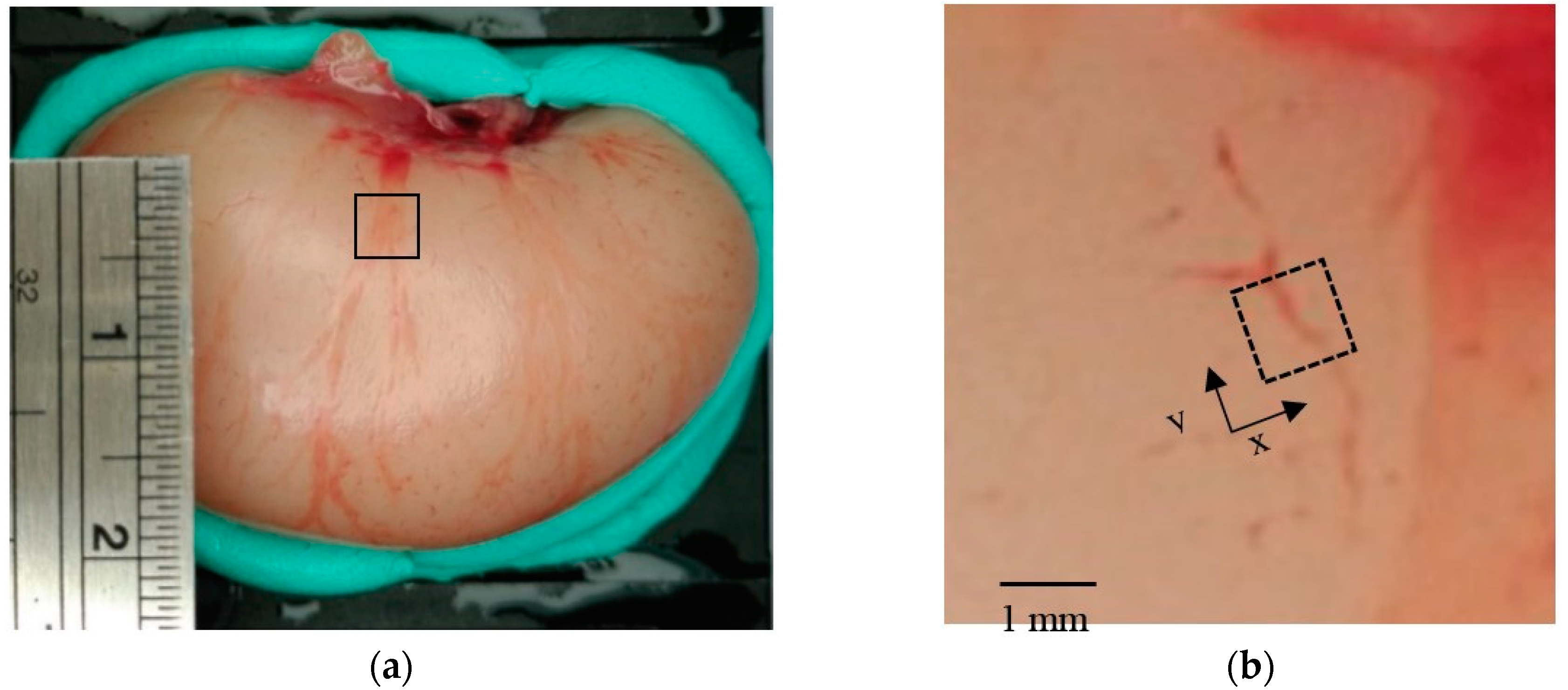 Diagnostics 10 00006 g011