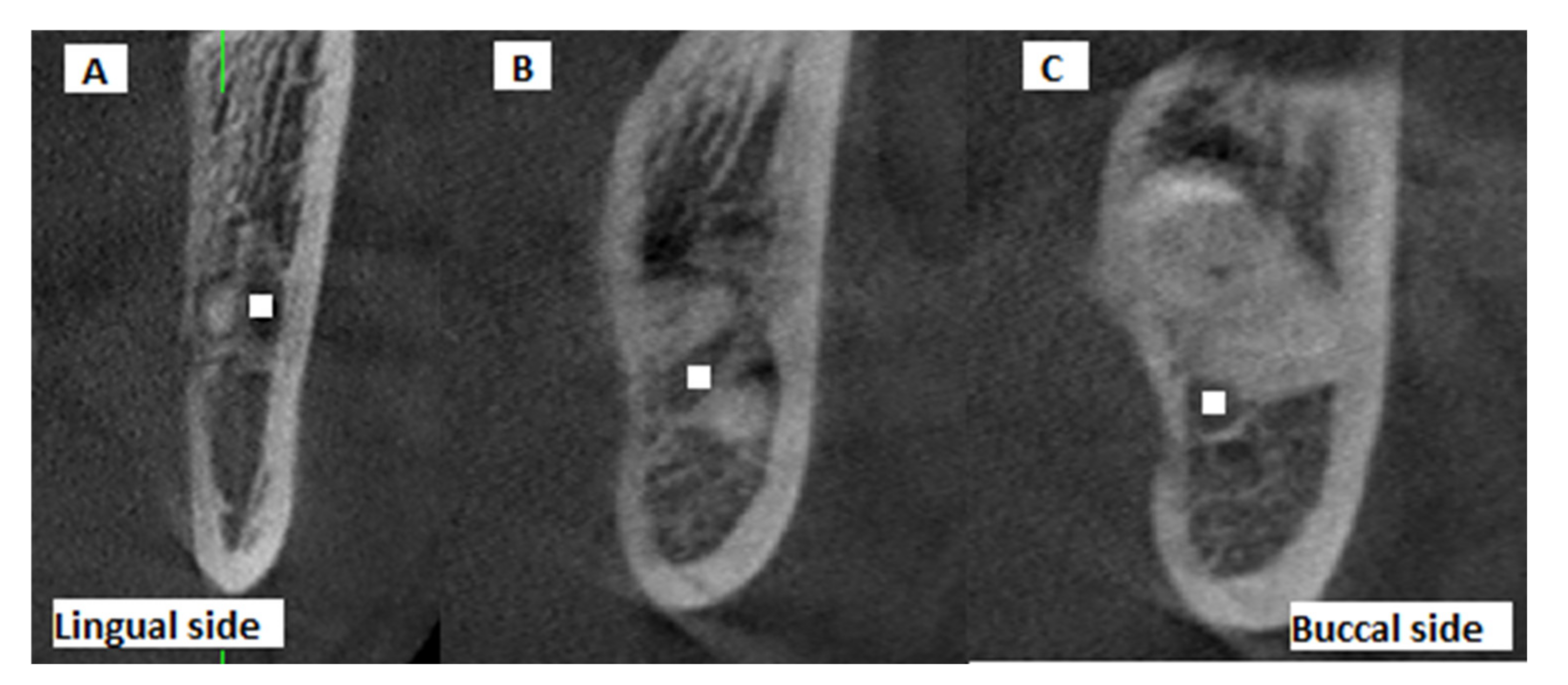 Diagnostics Free Full Text Positive Predictive Value Of Panoramic