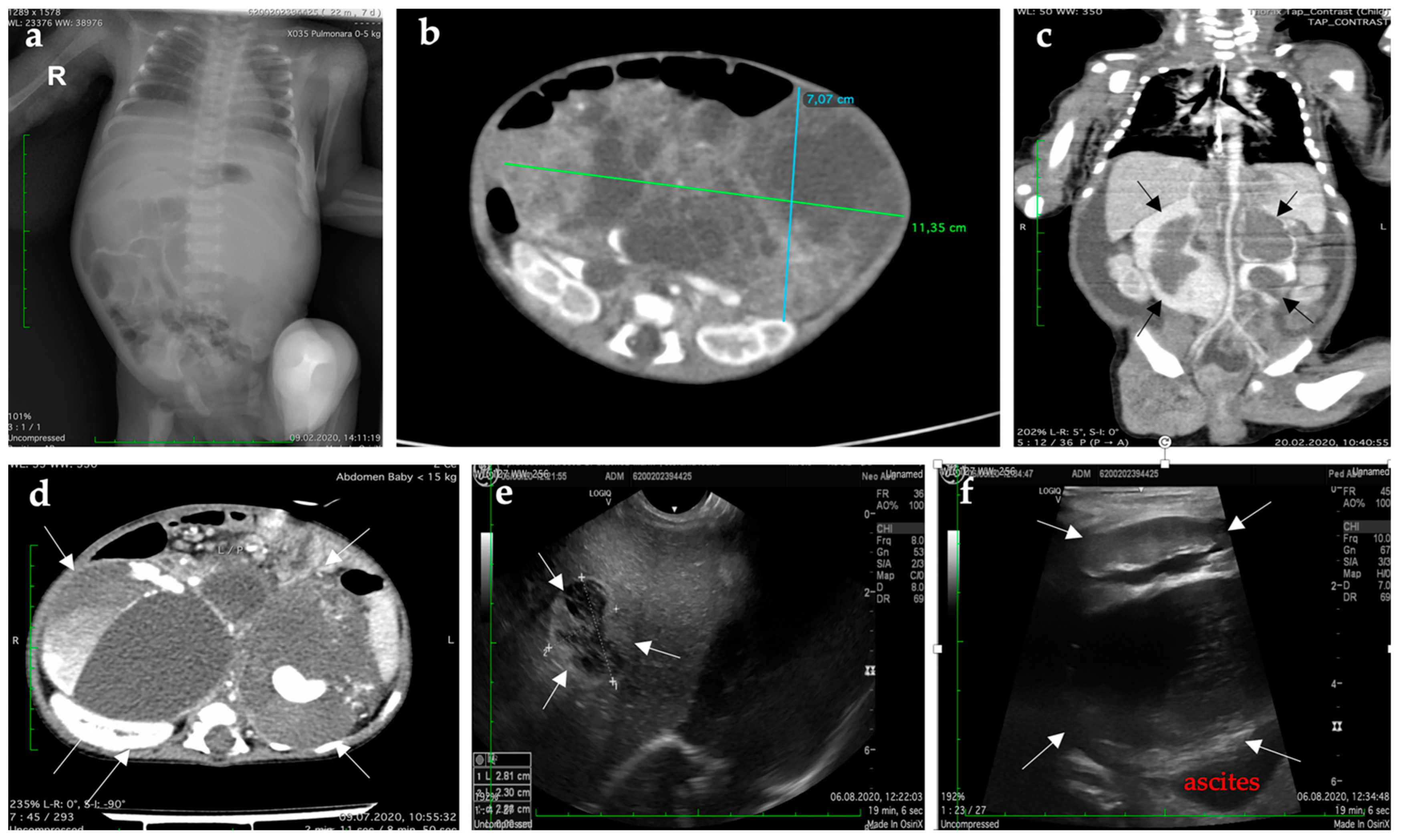 Diagnostics 12 00758 g002 Diagnostics 12 00758 g002