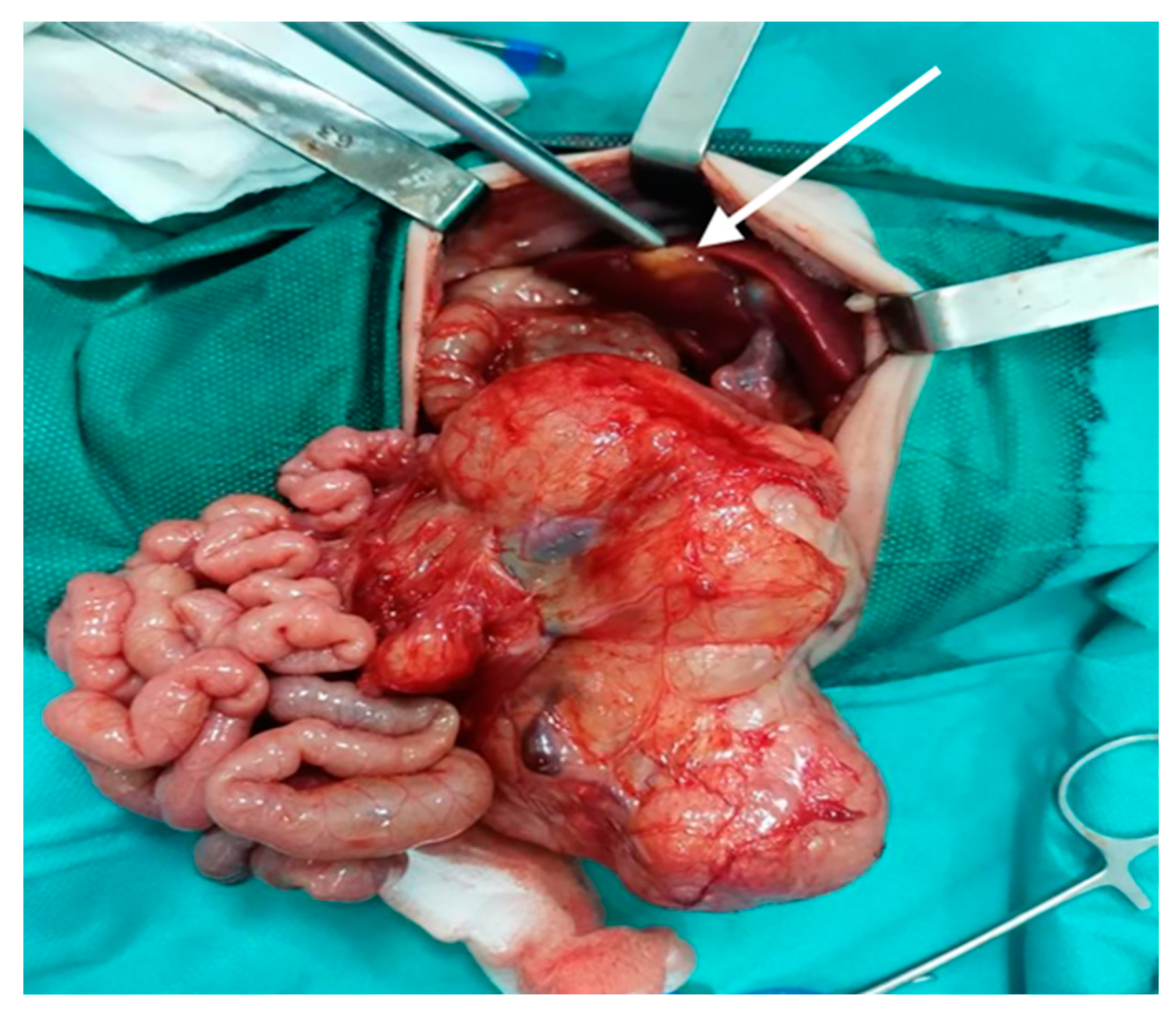 Diagnostics 12 00758 g003 Diagnostics 12 00758 g003