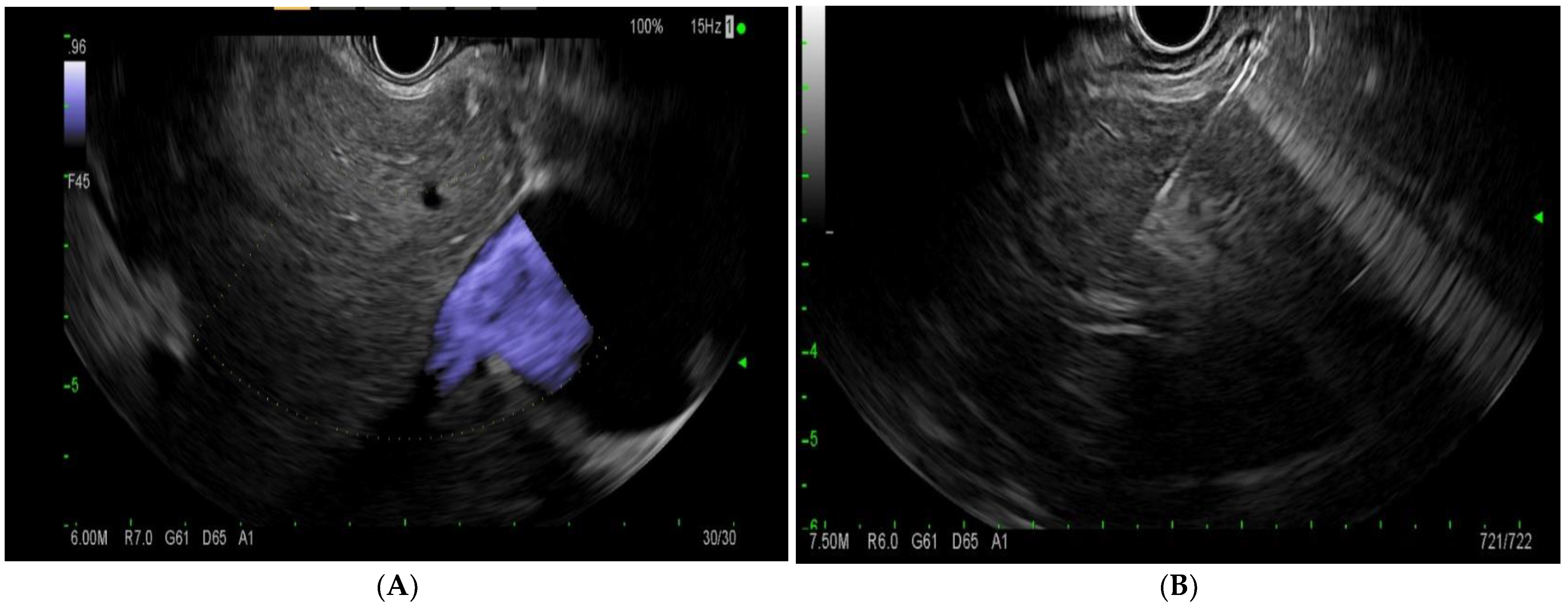 Diagnostics Free Full Text Advances In Endoscopic Ultrasound Eus