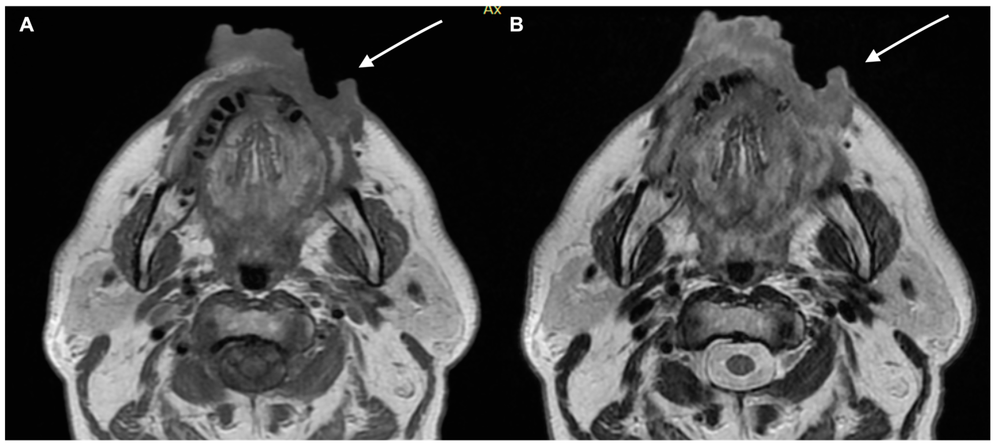 Diagnostics 13 00793 g004