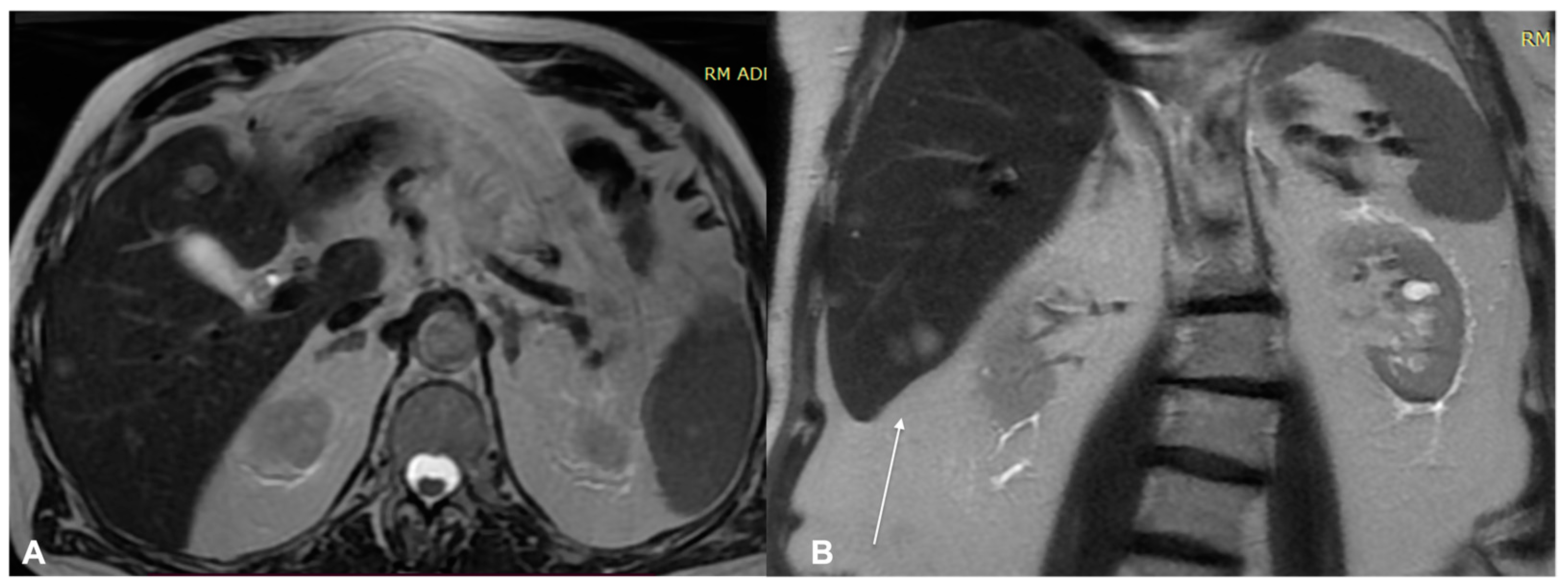 Diagnostics 13 00793 g010