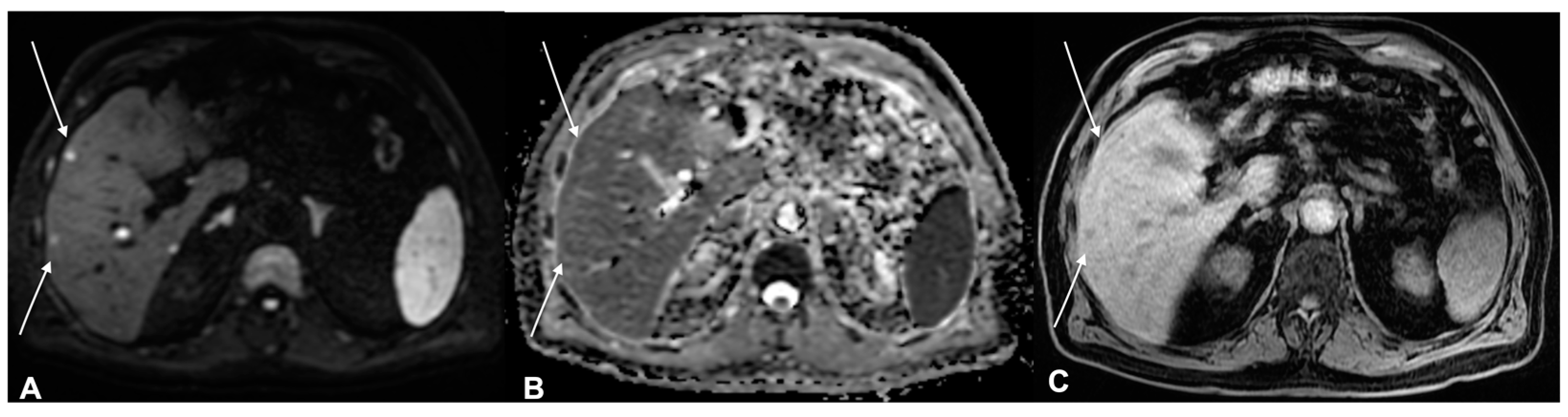 Diagnostics 13 00793 g011