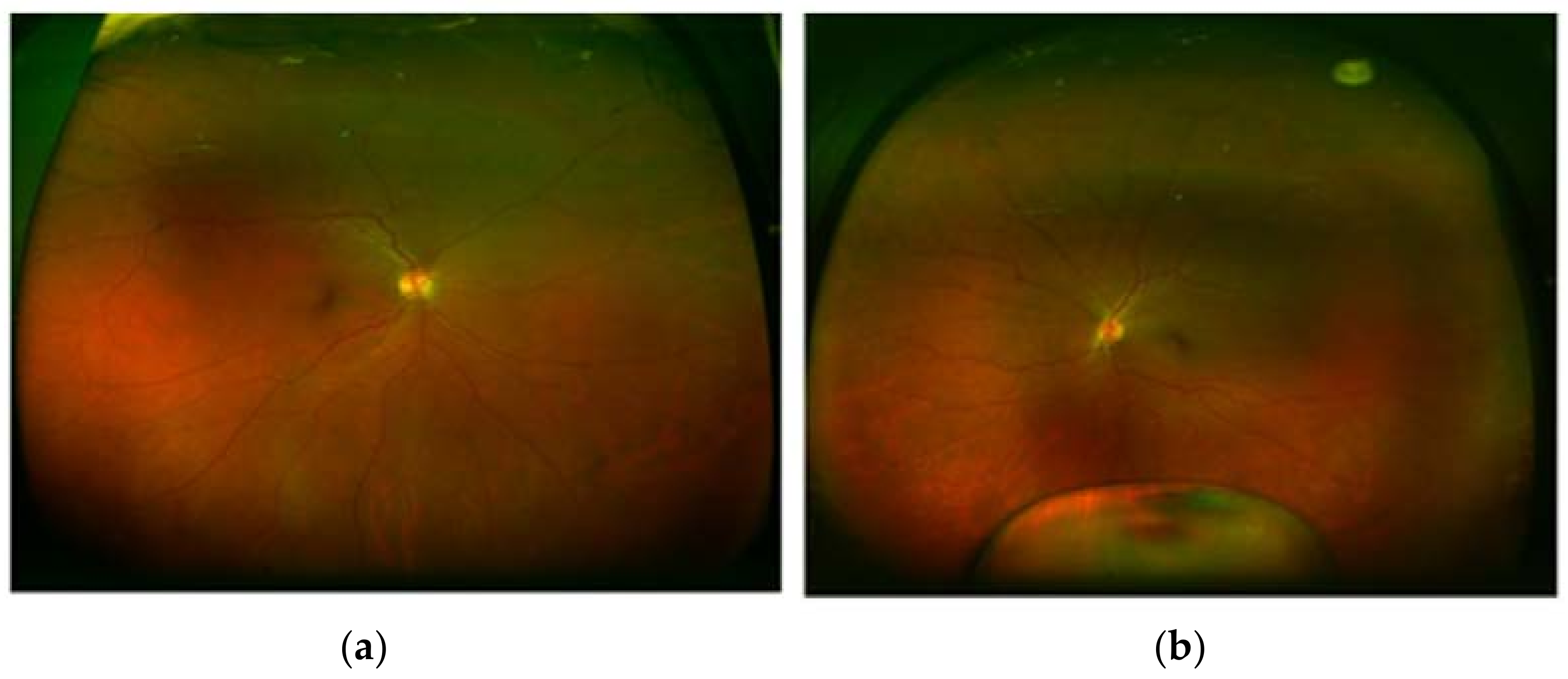 Diagnostics 13 01400 g003 Diagnostics 13 01400 g003